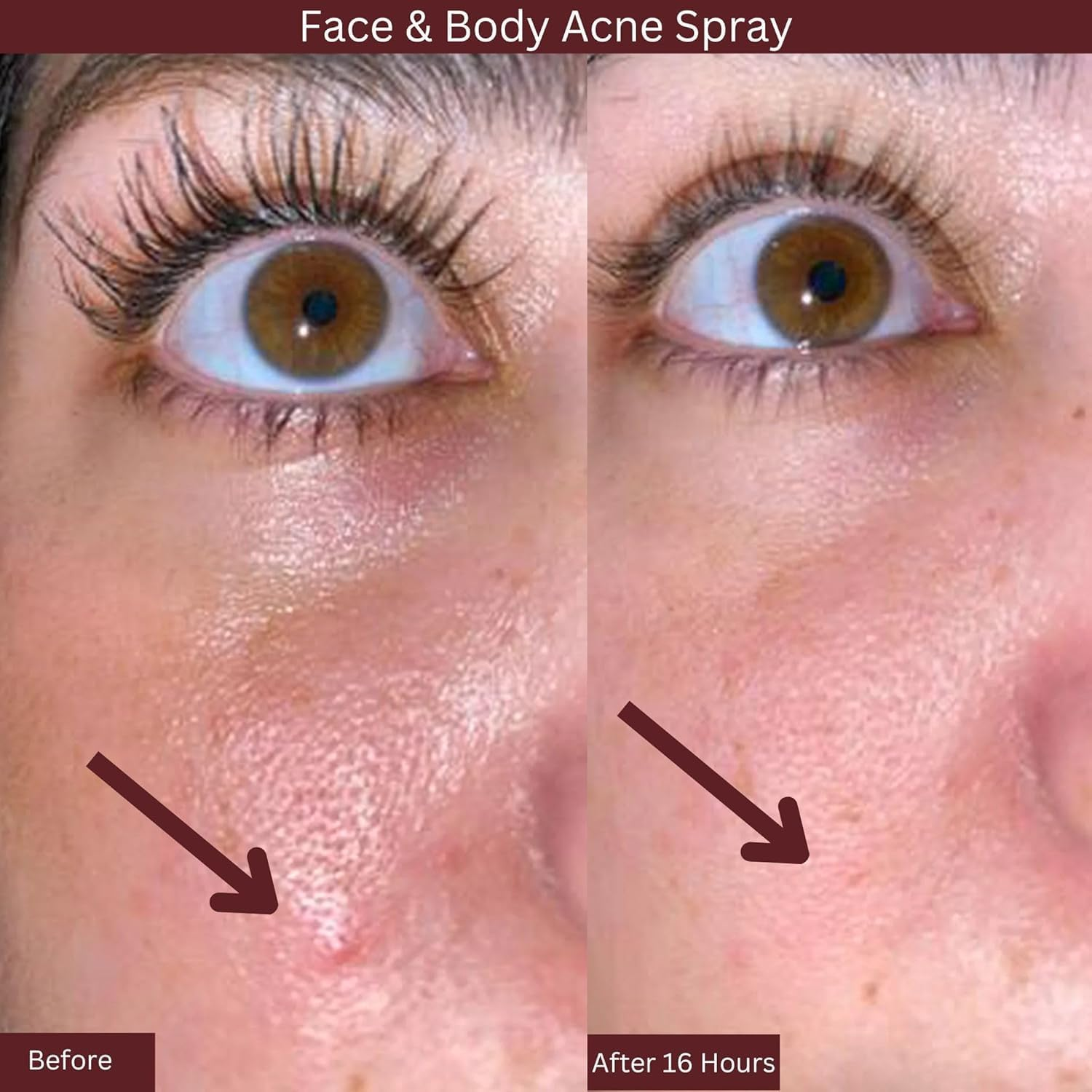 Blemish Treatment Mist by ITK for Unisex - 3.3 Oz Mist image number 3