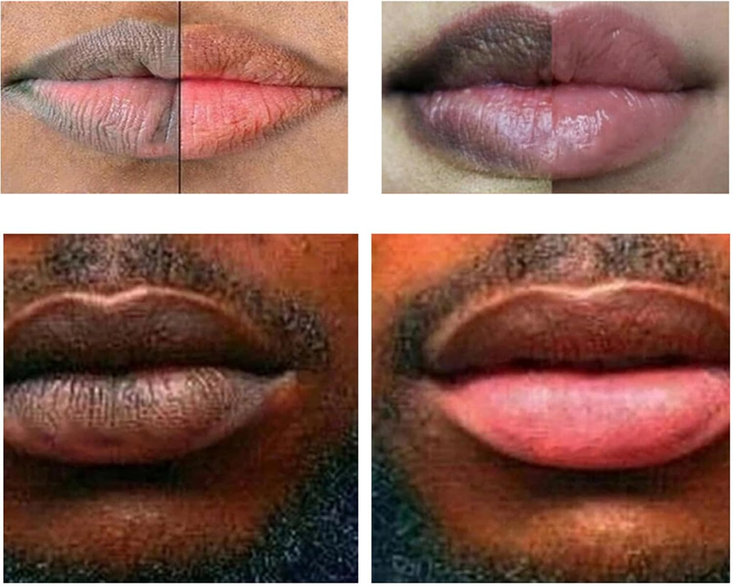 Lip Lightening for Dark Lips, Lip Scrub for Dark Lips, Lips Pink Lightening Cream, Lip Lightener for Dark Lips, Effectively Exfoliate image number 1