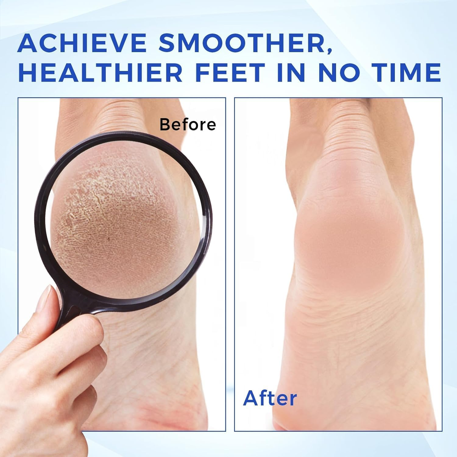 OUKEYA 40% Urea Cream, Foot & Hand Cream with Foot File, Maximum Strength Moisturising Lotion for Dry Cracked Skin, Softening Care for Feet, Heels & Hands, Intensive Hydration, 150G image number 4