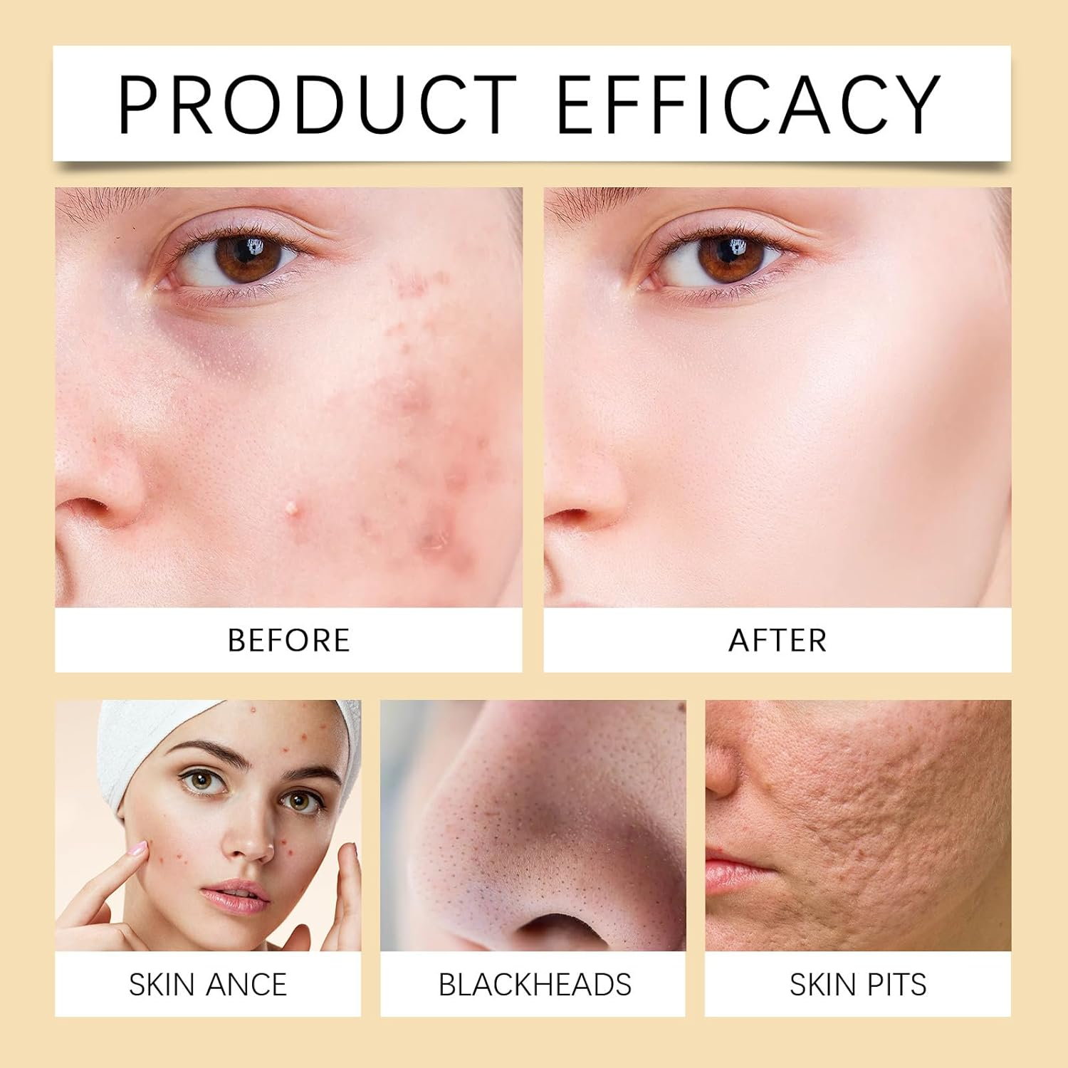 Turmeric Face Wash with Brush, Foaming Facial Cleanser for Deep Cleansing and Exfoliating, Brightening & Moisturizing Turmeric Cleanser for Women & Men, Gentle for All Skin Types (6Pcs)