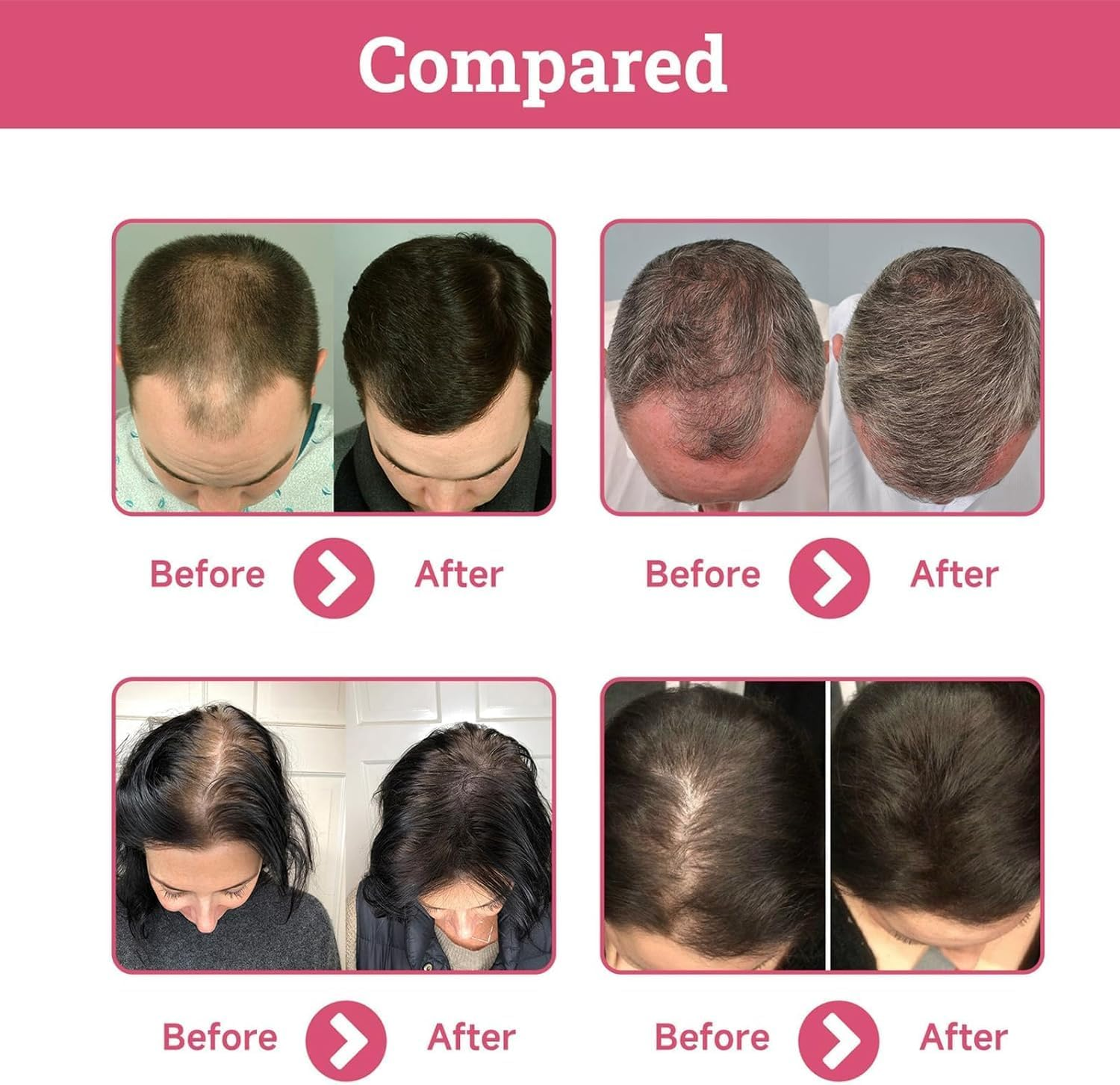 GTWEPZ 2Pcs Strawberry Mint Growth Oil,Strawberry Mint Hair Growth Oil,Organic Hair Growth Serum for Thin Hair Dry Damaged Hair, Beige image number 2