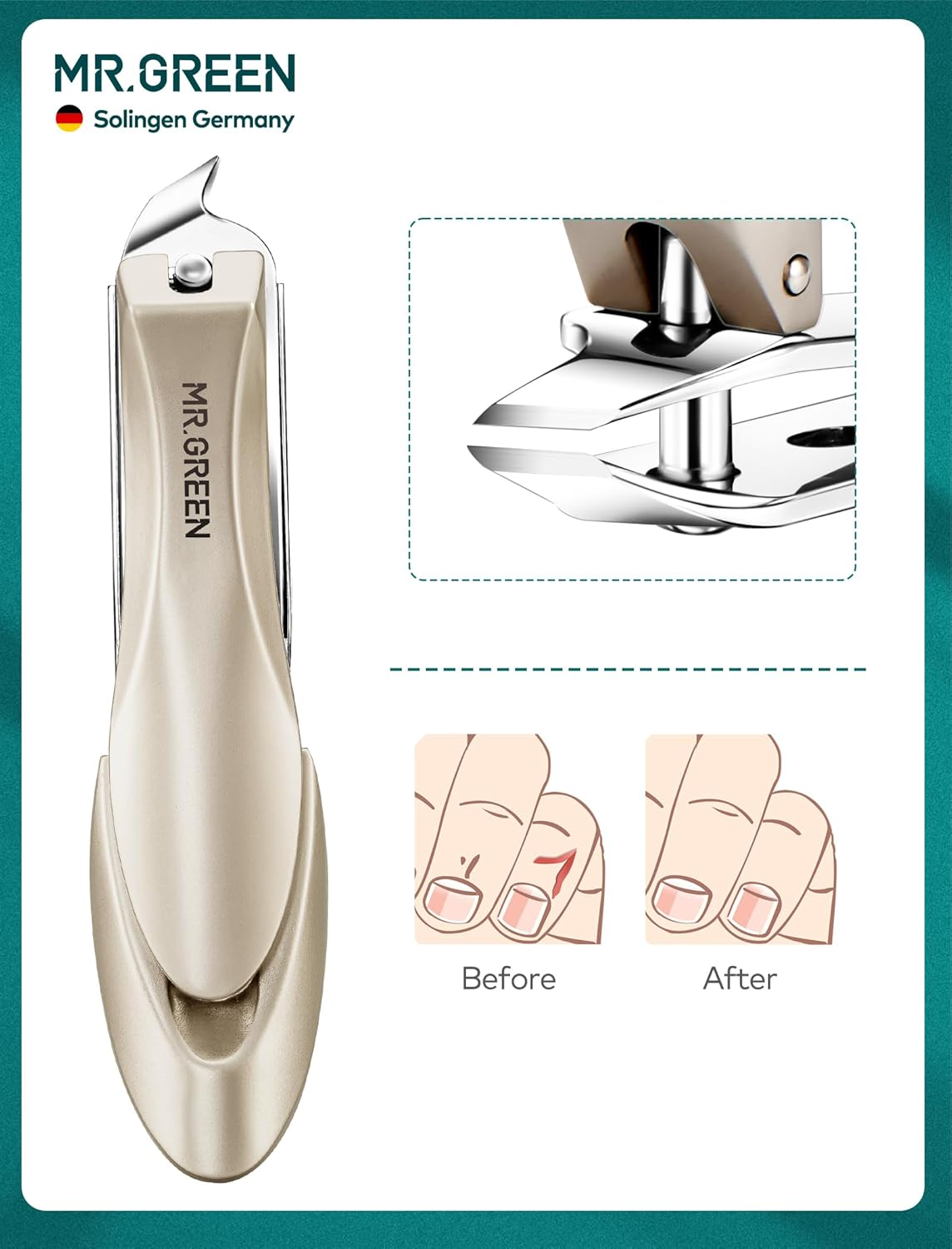 MR.GREEN Nail Clippers, 3PCS Nail Clipper Set with anti Splash Fingernail Clipper and Ear Pick, Professional Nail Clippers for Men and Women, Stainless Steel Nail Cutter with Leather Case (Green) image number 3