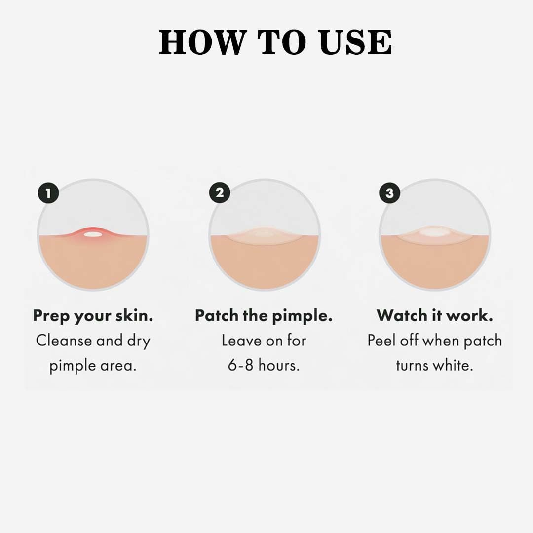 ABC Acne Pimple Patch for Face (36 Dots) | Waterproof Patches for Active Acne | Absorbs Pimple Overnight and Reduces Excess Oil | Facial Patches with 100% Hydrocolloid image number 1