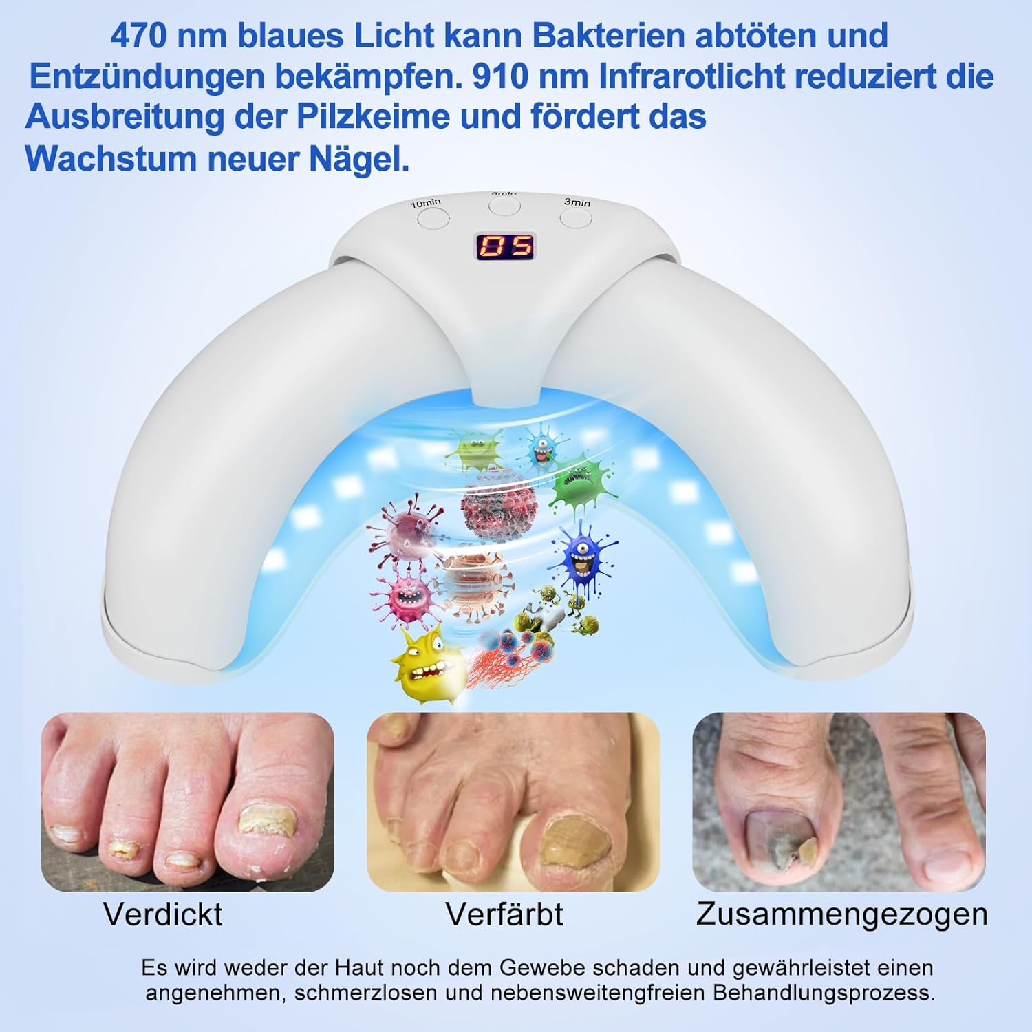 Nail Fungus Cleaning Device for Multiple Toenail,Suitable for Discolored and Thickened Toenails,Foldable 910 Nm Infrared Light + 470Nm Blue Light Nail Fungus Treatment Device,Safe & Effective image number 2