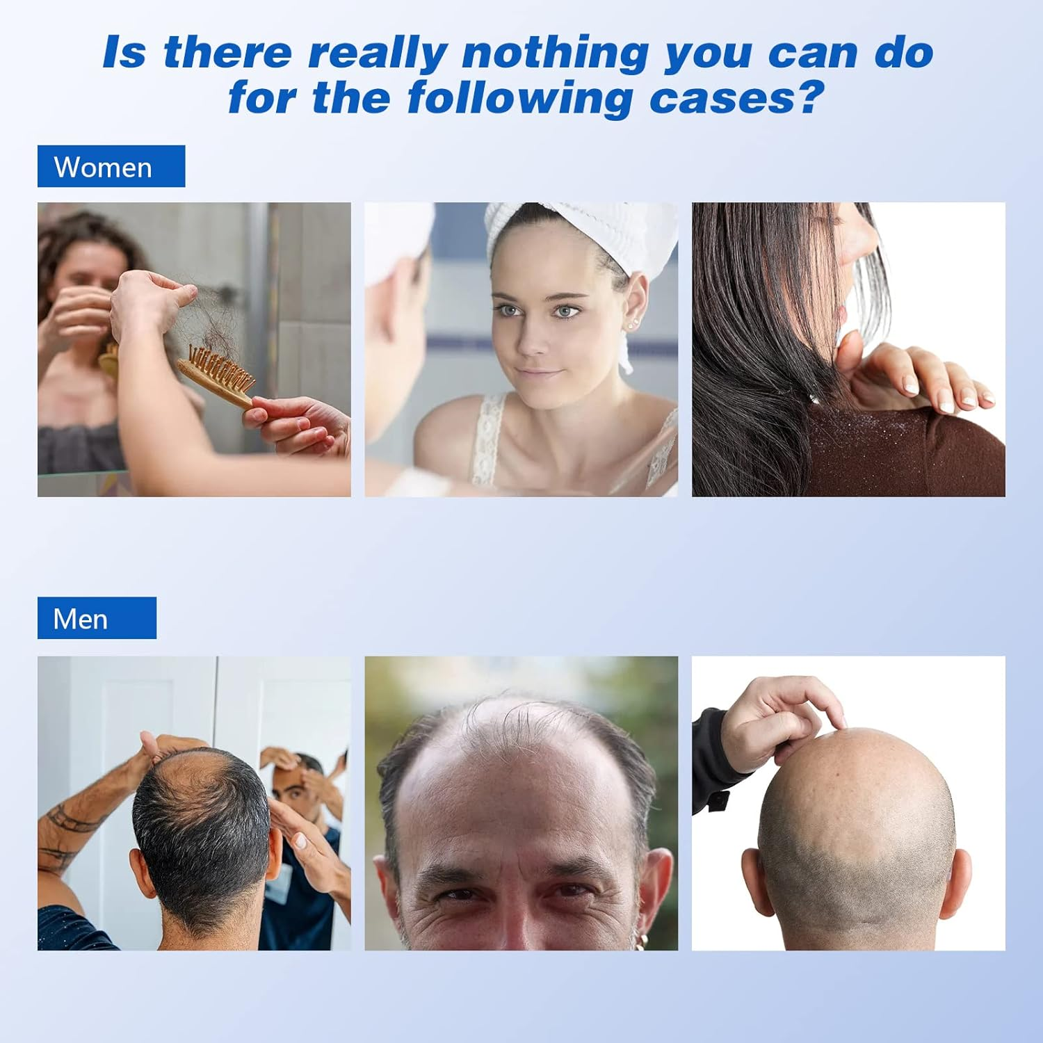 KTS Red Light Therapy Hair Growth Helmet, 236 Diodes Hair Growth Cape, FDA Cleared Hair Growth Device, Hair Loss Treatment for Men and Women Thinning Hair, Restore Hair Thickness