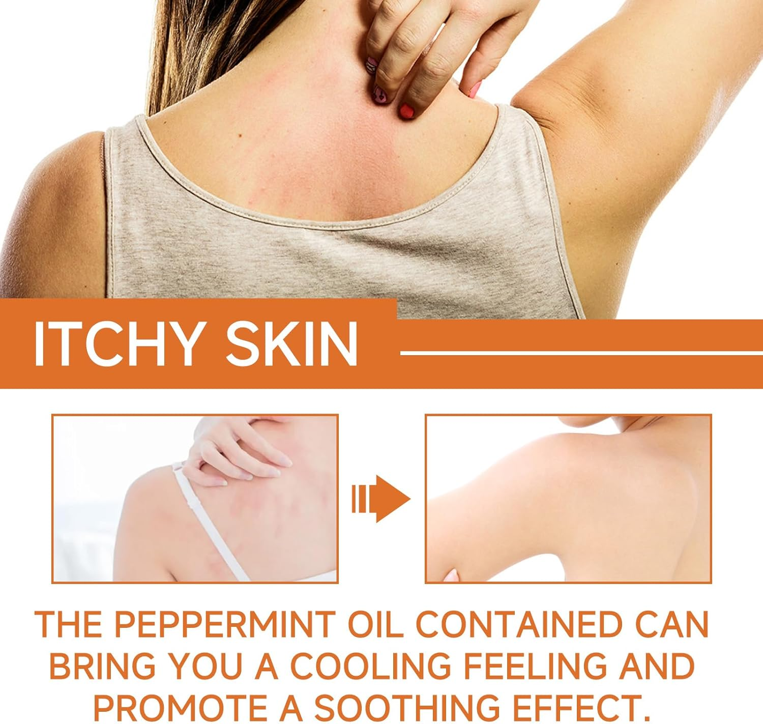 20G Skin Care Cream, Can Relieve Redness, Itching, Relieve and Moisturize Skin Care image number 5