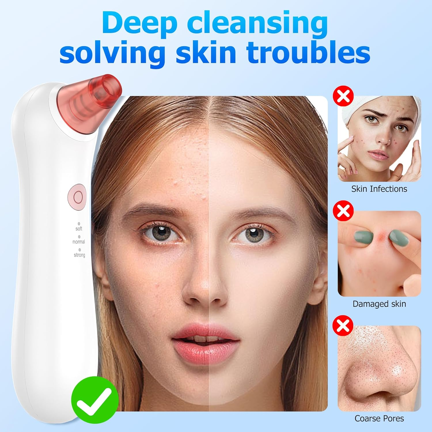Blackhead Remover Pore Vacuum, Pore Extractor & Blackhead Removal Tools. Features 3 Adjustable Modes and 4 Probes for Removing Blackheads, Whiteheads, and Acne. Deeply Cleans the Skin image number 2
