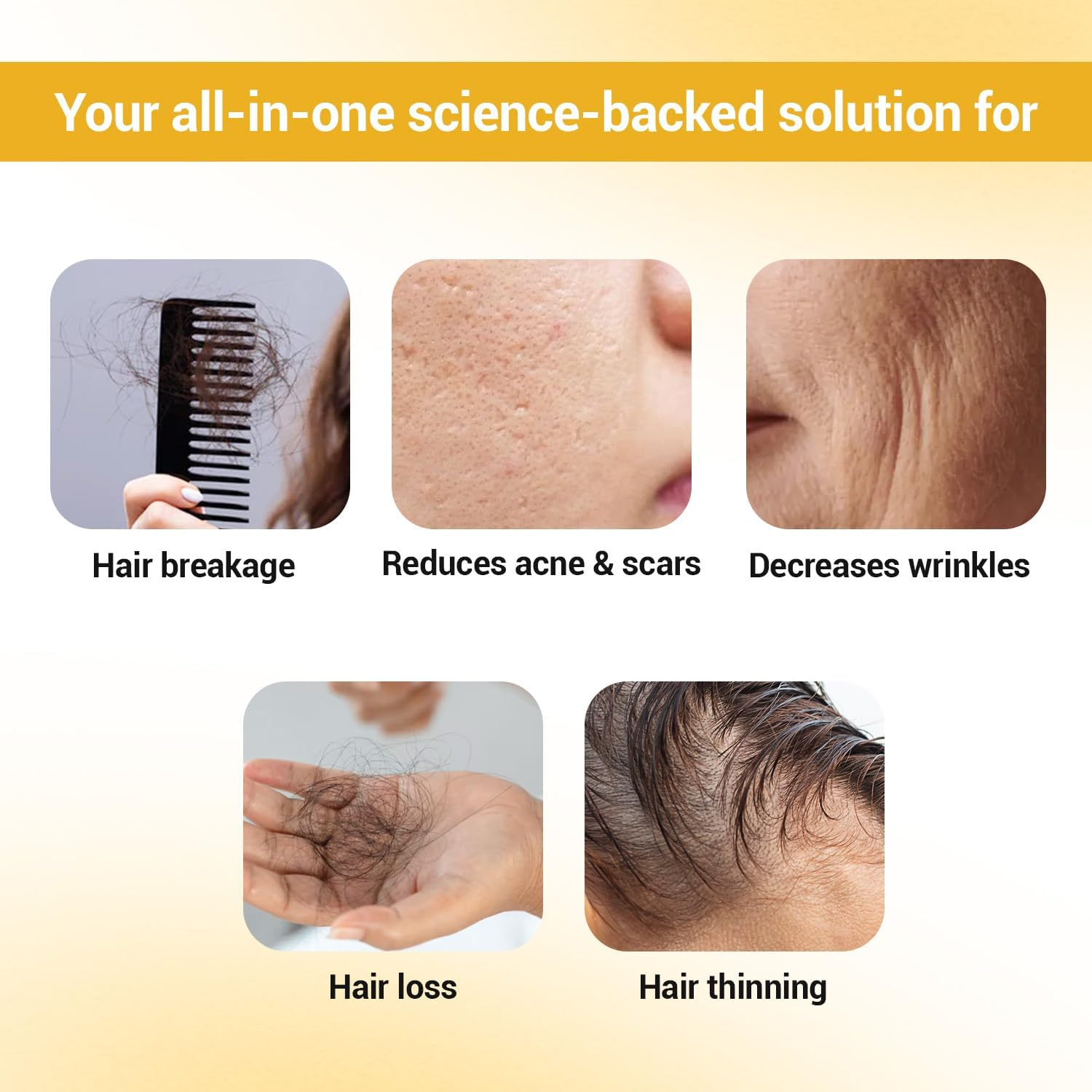 Sotrue Professional Derma Roller for Hair Growth 1 Mm with 192 Stainless Steel Needles Repairs Damaged Hair,Hair Thickening Reduces Acne Scars Safe Effective to Use image number 3