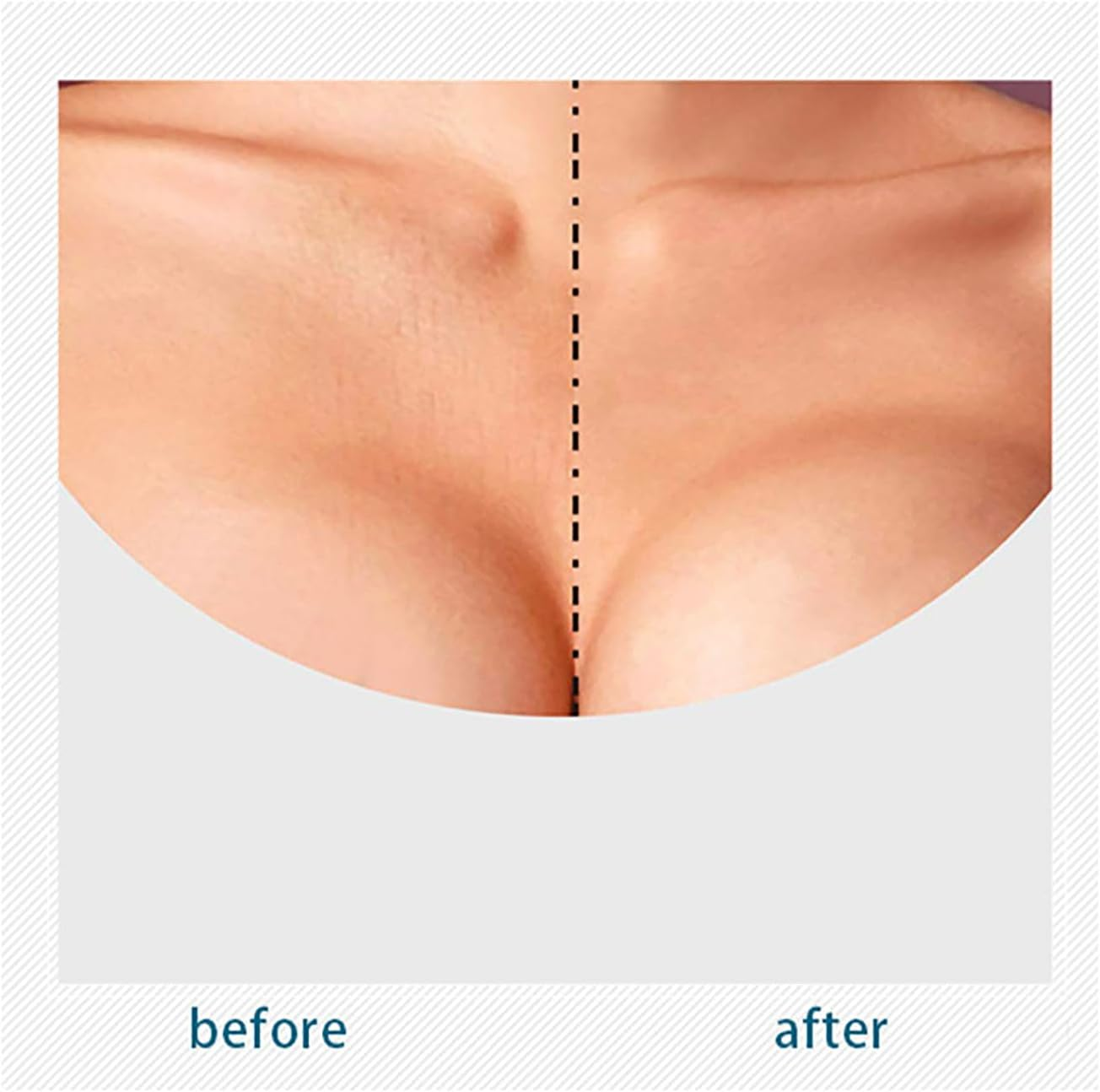 Volksrose Reusable Silicone Wrinkle Patches for Face & Chest & Neck &ndash; Forehead, under Eye Anti-Wrinkle Patches, Smooth Fine Lines & Lift Skin, Overnight Invisible Smoothing Gel Mask, Anti-Aging Pads image number 4