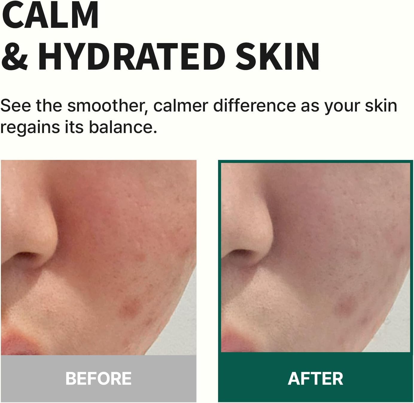 MILLE DE FLEUR Etoile Moist Calming Serum 100Ml, Korean Vegan Skincare, Soothing Serum for Sensitive Skin, Hydrating and Brightening Care, Infused with Greenol, Niacinamide, and Floral Extracts image number 2