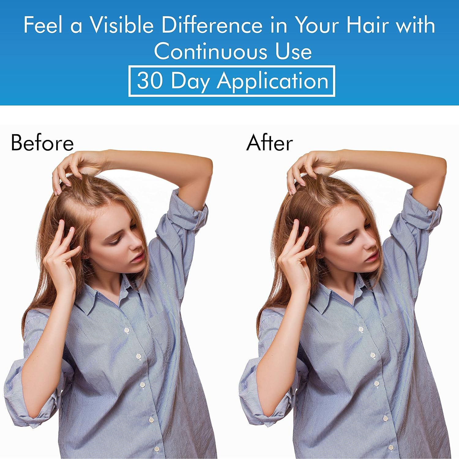 MD Factor Suero Natural Para El Crecimiento Del Cabello | Follicle Energizer Serum: Evita El Adelgazamiento Del Cabello Y La P&eacute;rdida De Cabello Al Estimular Los Fol&iacute;culos Capilares Para Producir Un Ca image number 1