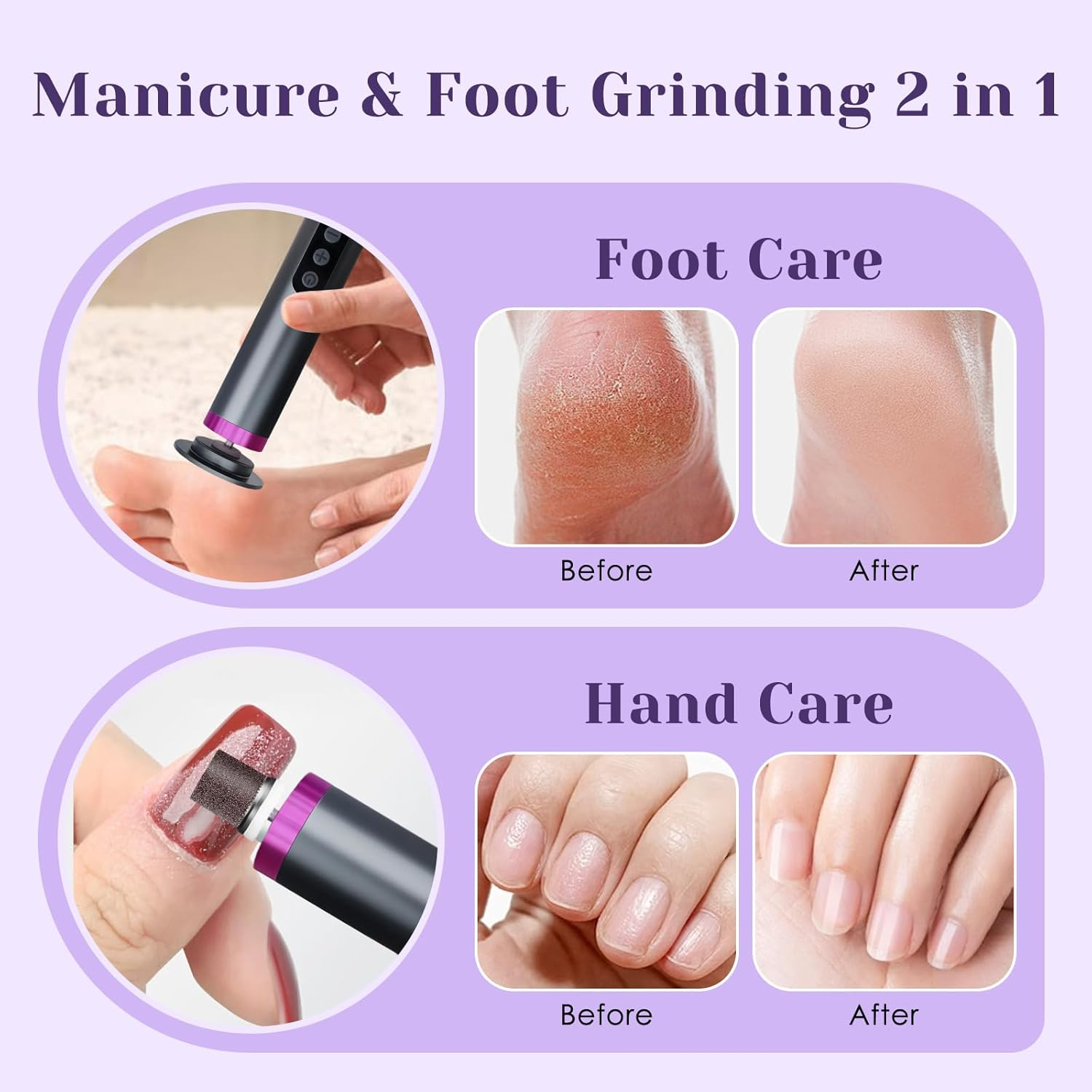 Electric Callus Remover, 9 Speed Levels, Aluminium Housing and 2000 Mah Battery for Callus Removal on Feet, Ideal for Home Foot Care and Professional Cosmetic Studios (Black) image number 6