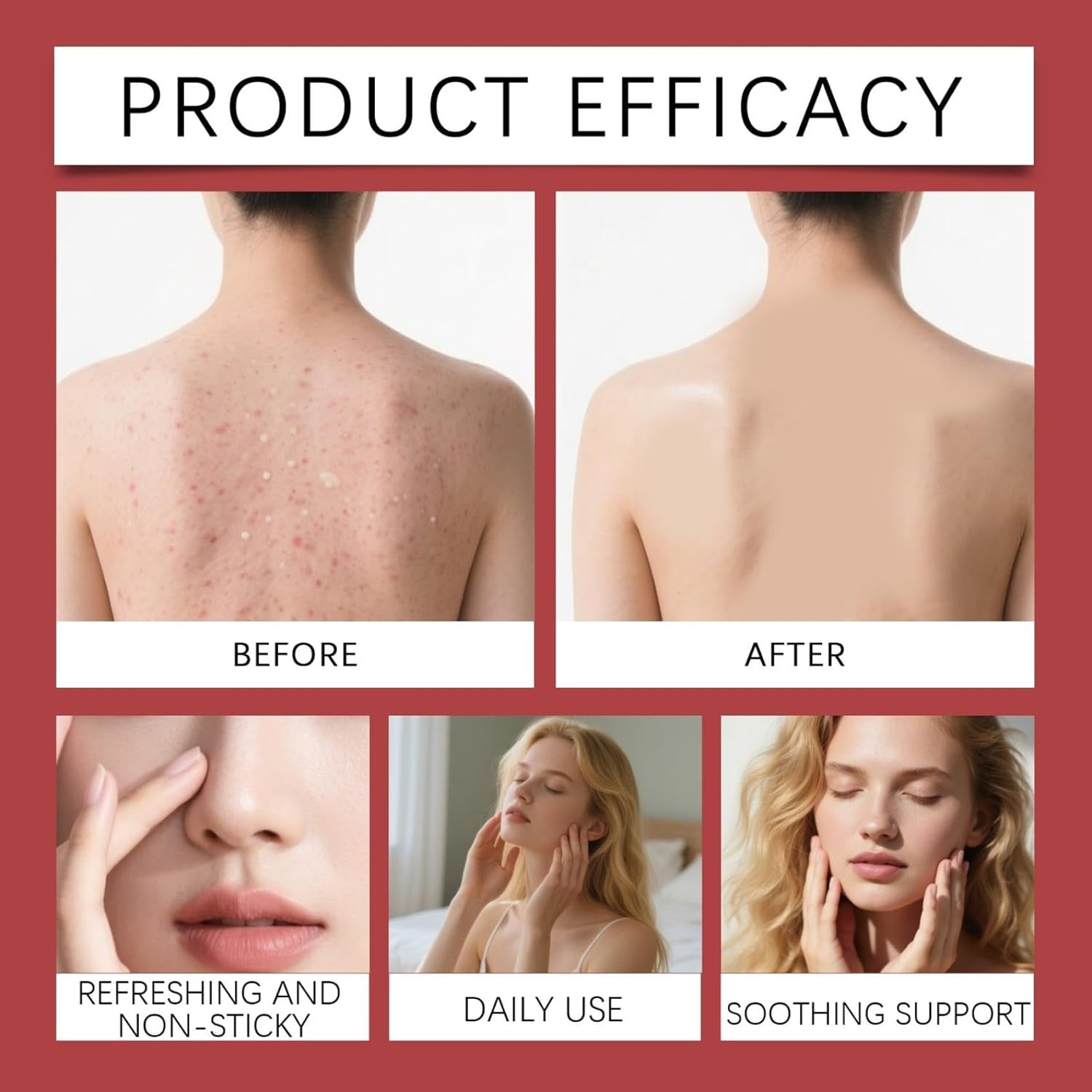 Strawberry Skin Resurfacing Cream,Moisturizing and Lightweight Creams,Reduce Chicken Skin Bumps and Uneven Texture,For All Skin Types - 2Pcs image number 5