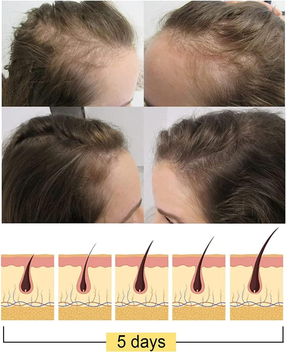 Shampoo Bar,Anti Hair Loss Rice Shampoo Soap,2 in 1 Fermented Rice Water for Hair Growth Solid Shampoo Bar,Nourish Dry Damaged Hair Repair (1Pcs) image number 5