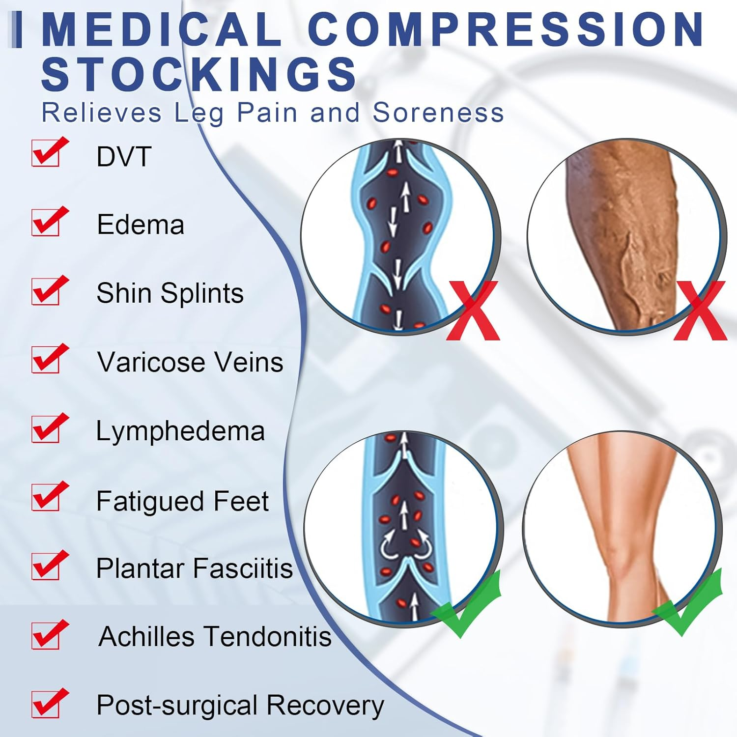 Beister Compression Stockings 20-30 Mmhg for Women & Men, 1 Pair Medical Thigh High Closed Toe Socks for Varicose Veins, Edema, Flight image number 1