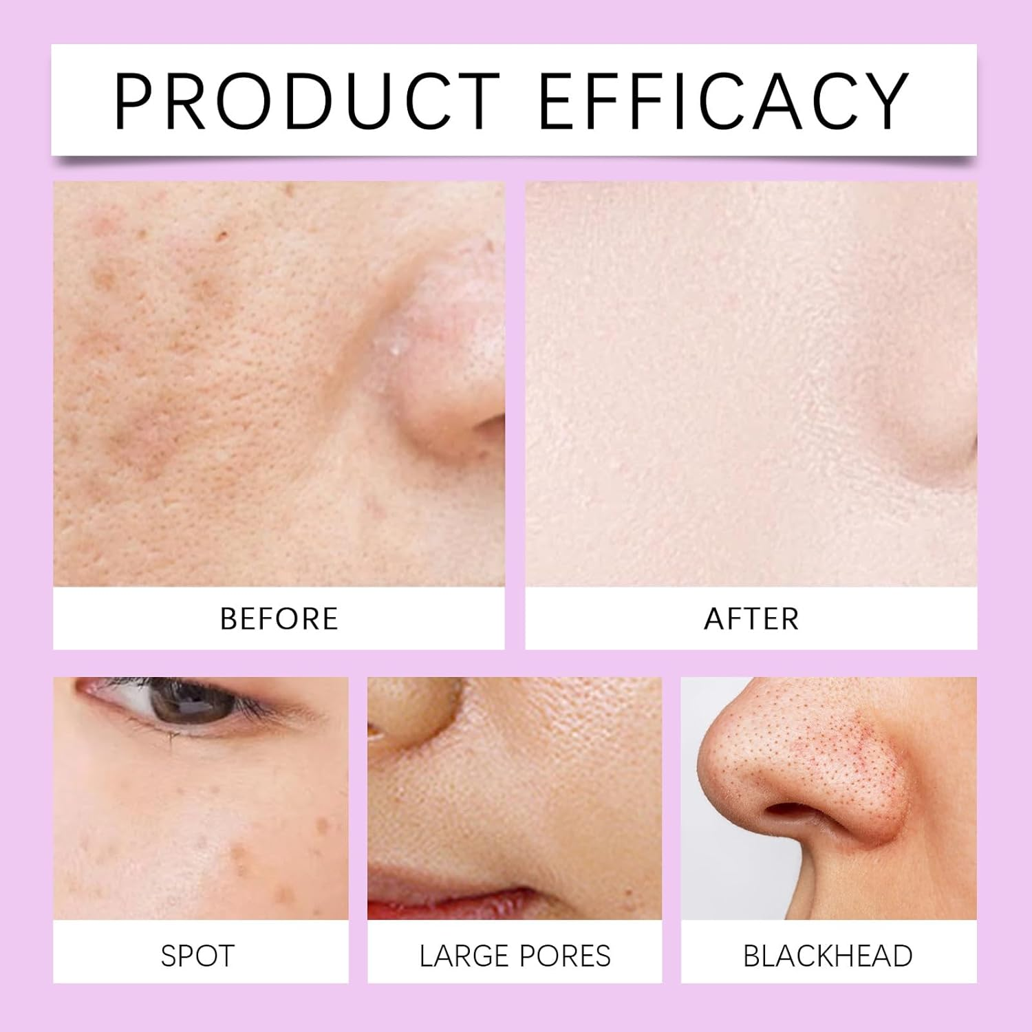 Advanced Anti-Hyperpigmentation Essence, Pigmentation Removal Serum for Spots Correcting, Reduces Hyperpigmentation to Even Skin Tone & Improve Pores, Hydrating and Brightening (3Pcs) - 2Pcs image number 2