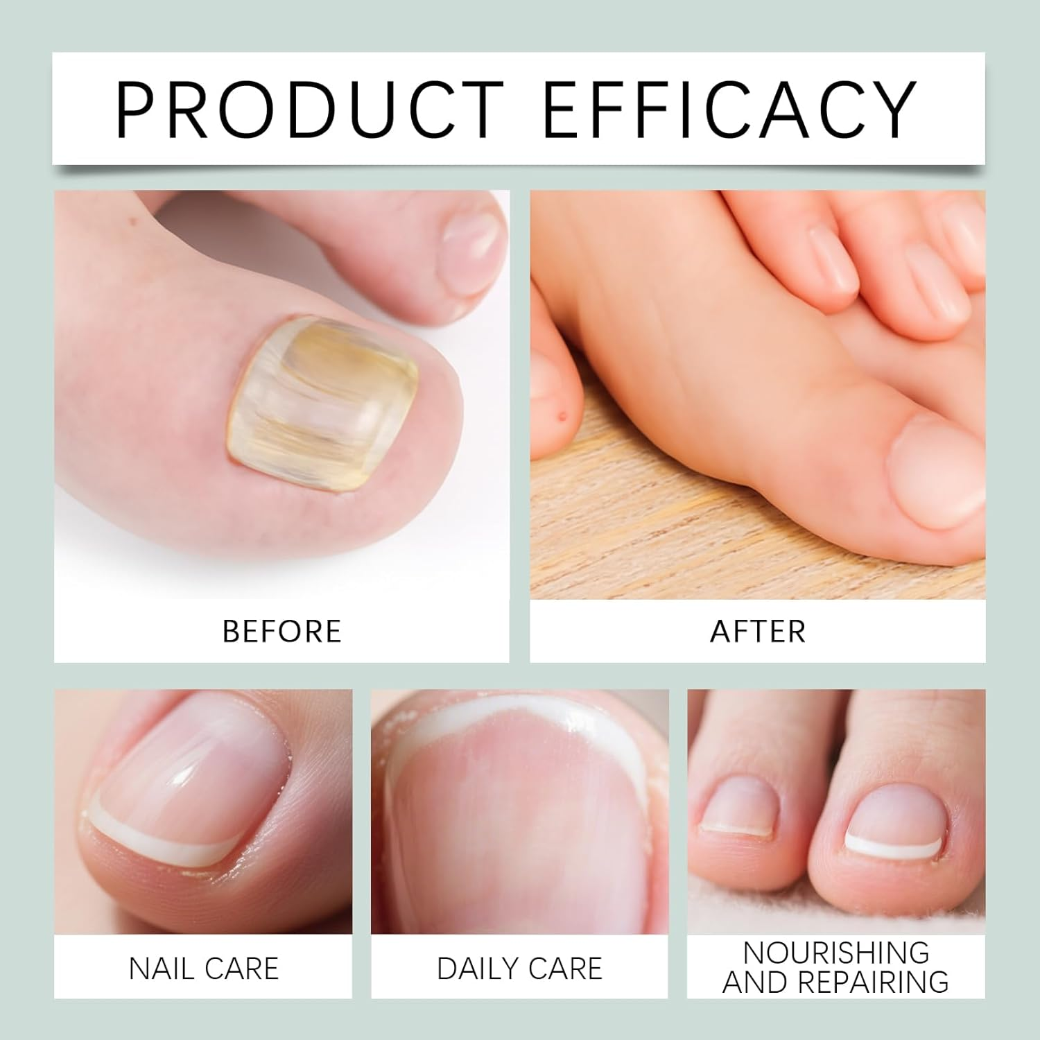 Ginger Nail Growth Serum, Nail Repair & Strengthener for Weak & Brittle Nails Serum, Damaged Broken Discolored Nails, 7 Days Toenail Treatment Extra Strength for Toenails Anti-Breakage Serums (4PCS) - 4Pcs image number 6