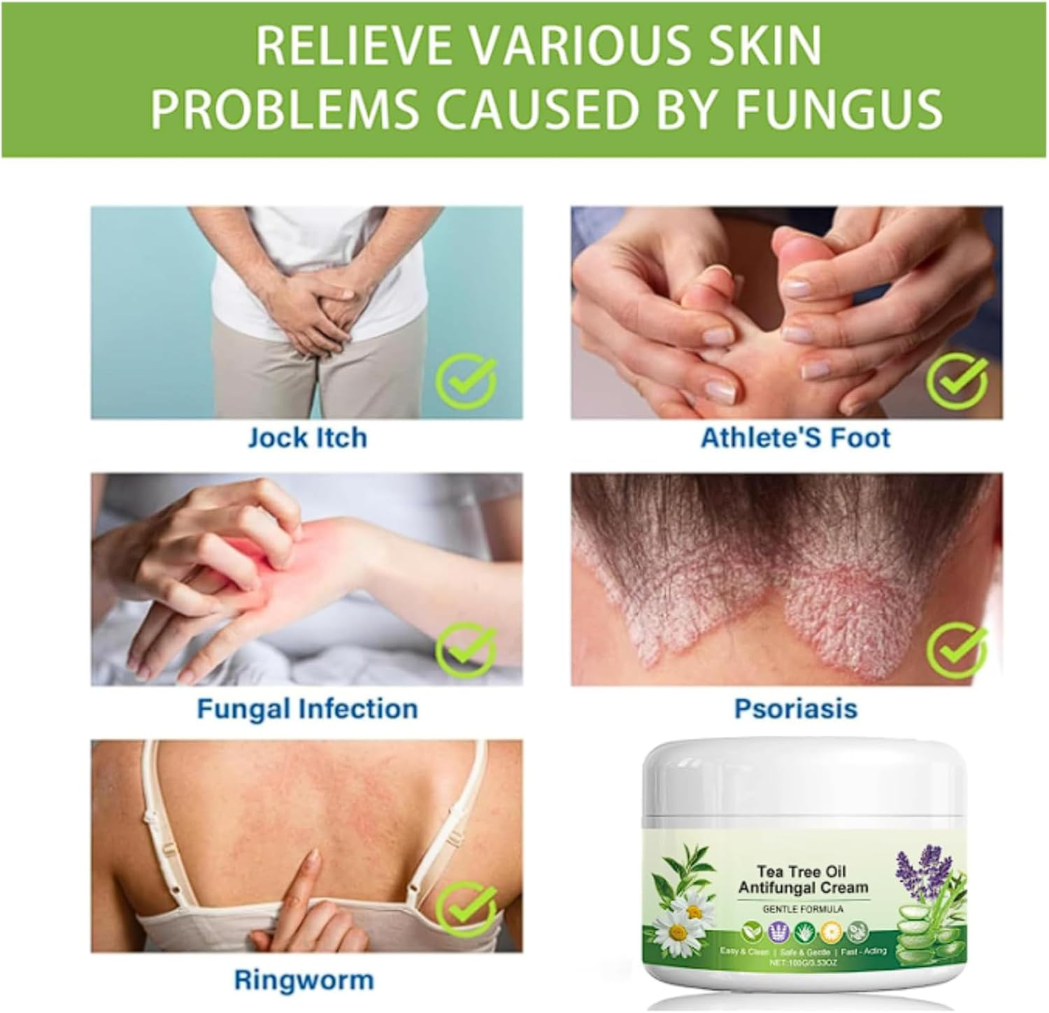 Tea Tree Oil Antifungal Cream, Soothing Moisturiser for Dry & Irritated Skin, Hydrating Foot & Hand Care with Natural Tea Tree Extracts for Men & Women (1Pcs) image number 1