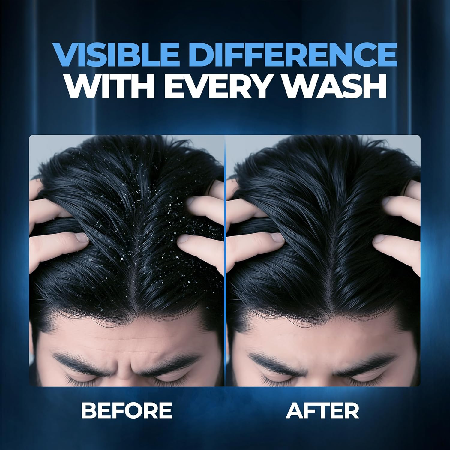 Beardo Dandruff Control Sulphate Free Shampoo 200 Ml | Biotin | Climbazole | Menthol | Reduce Dandruff and Itchy Scalp image number 4