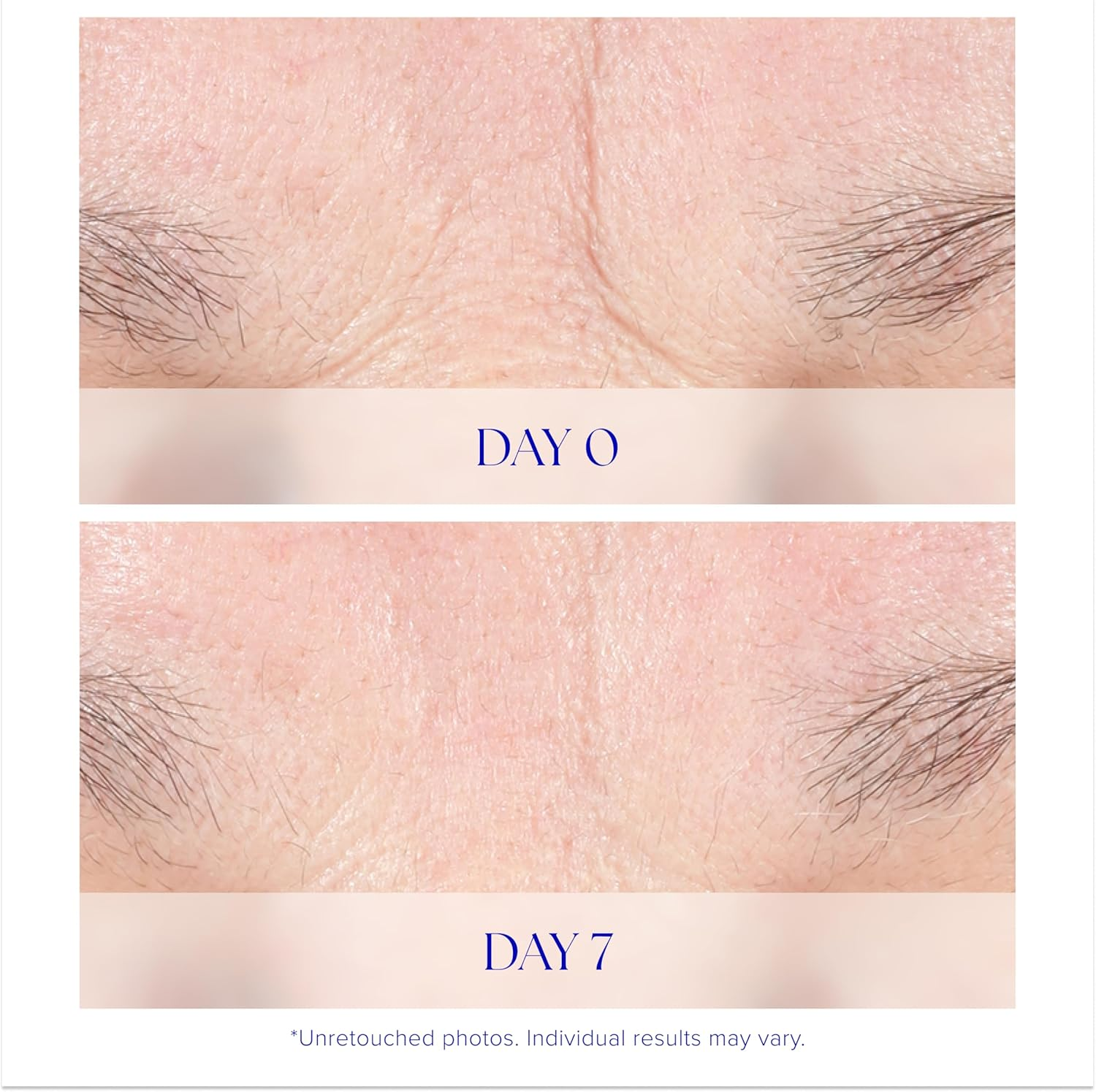 Is Clinical Youth Intensive Creme for Unisex 1.7 Oz Cream image number 4