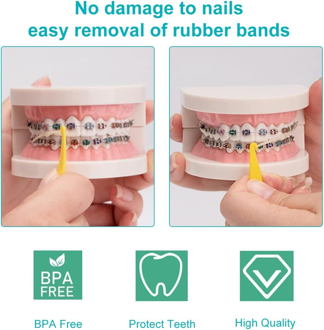 Pack of 10 Orthodontic Elastic Disposable Plastic Braces for Braces, Material Placement Removal Tools, Orthodontic Disposable Plastic Braces (Mixed Colour) image number 3