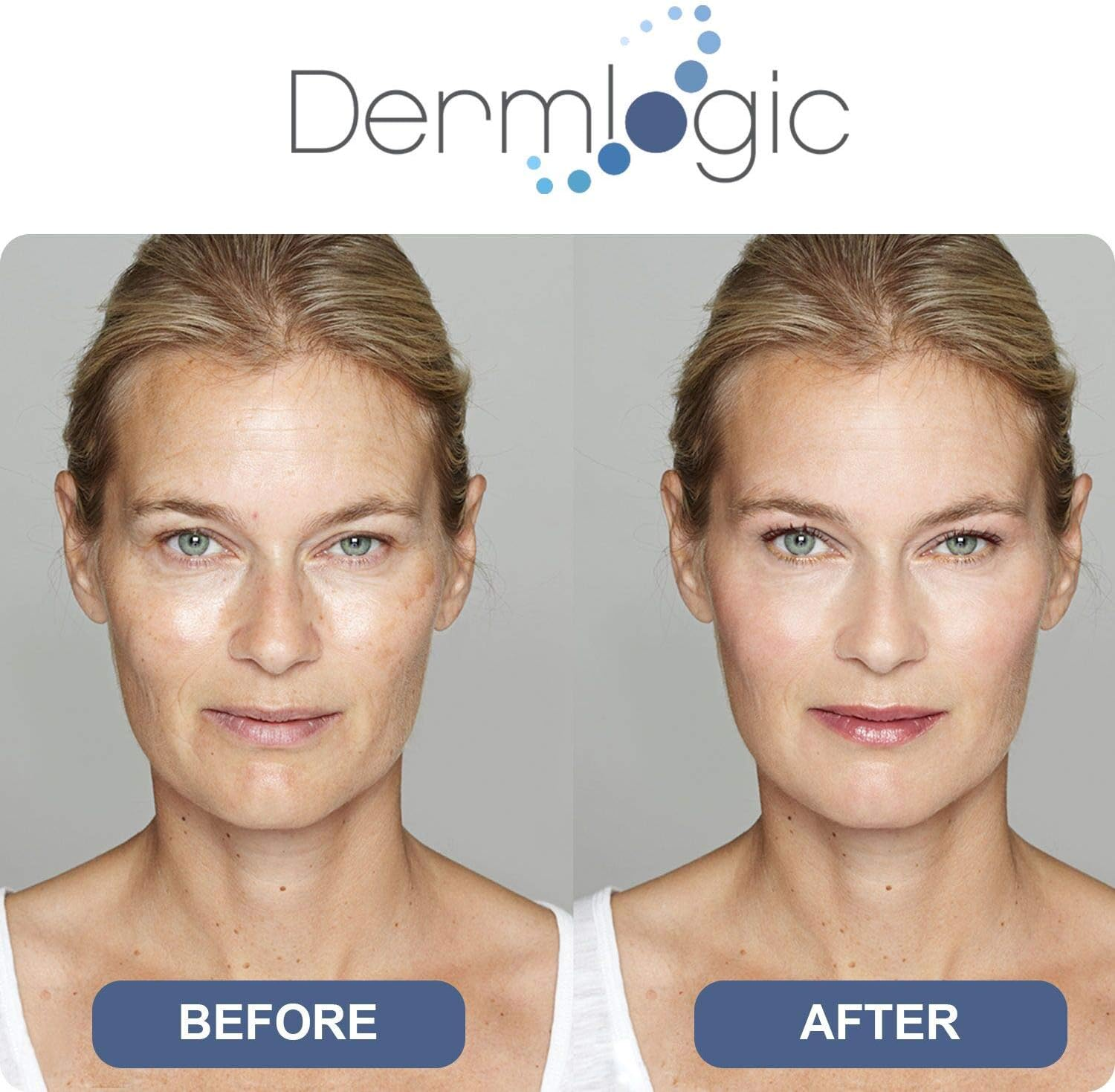 Dark Spot Corrector Cream- Visibly Fades & Repair Skin Discoloration from Dark Spots, Sun Spots, Age Spots, Acne Scars, Brown Spots, Freckles. Hydroquinone Free, No Harsh Chemicals for Face & Body image number 2