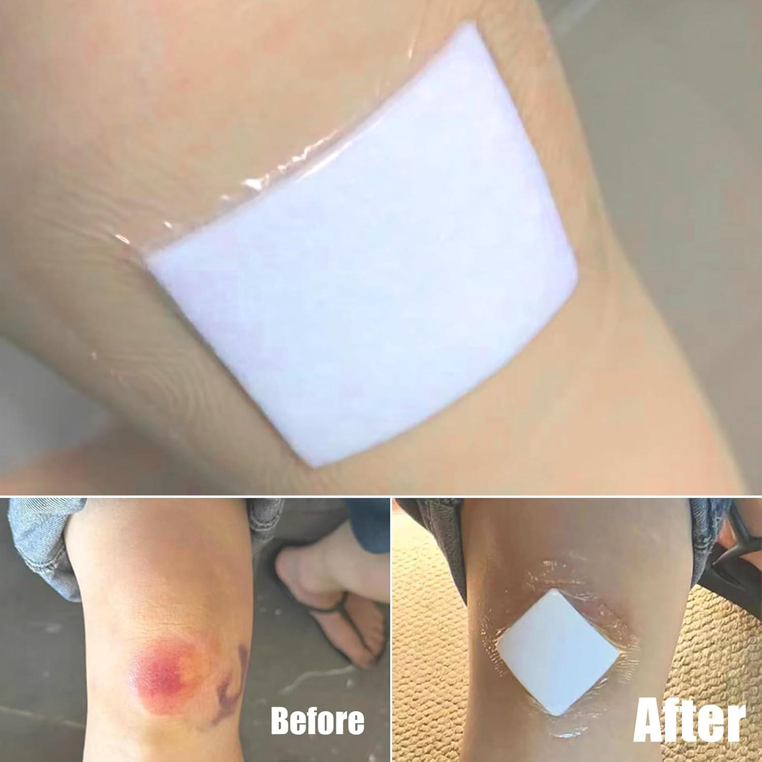 Waterproof Wound Dressings,Sterile Dressing Pad Adhesive Bandage Patches,Individually Wrapped,10Cmx10Cm,20Pcs image number 6