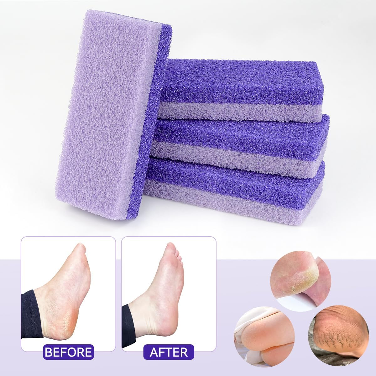 4 Pcs Foot Pumice Stone and Scrubber for Feet and Heels Callus and Dead Skins (Purple) image number 1
