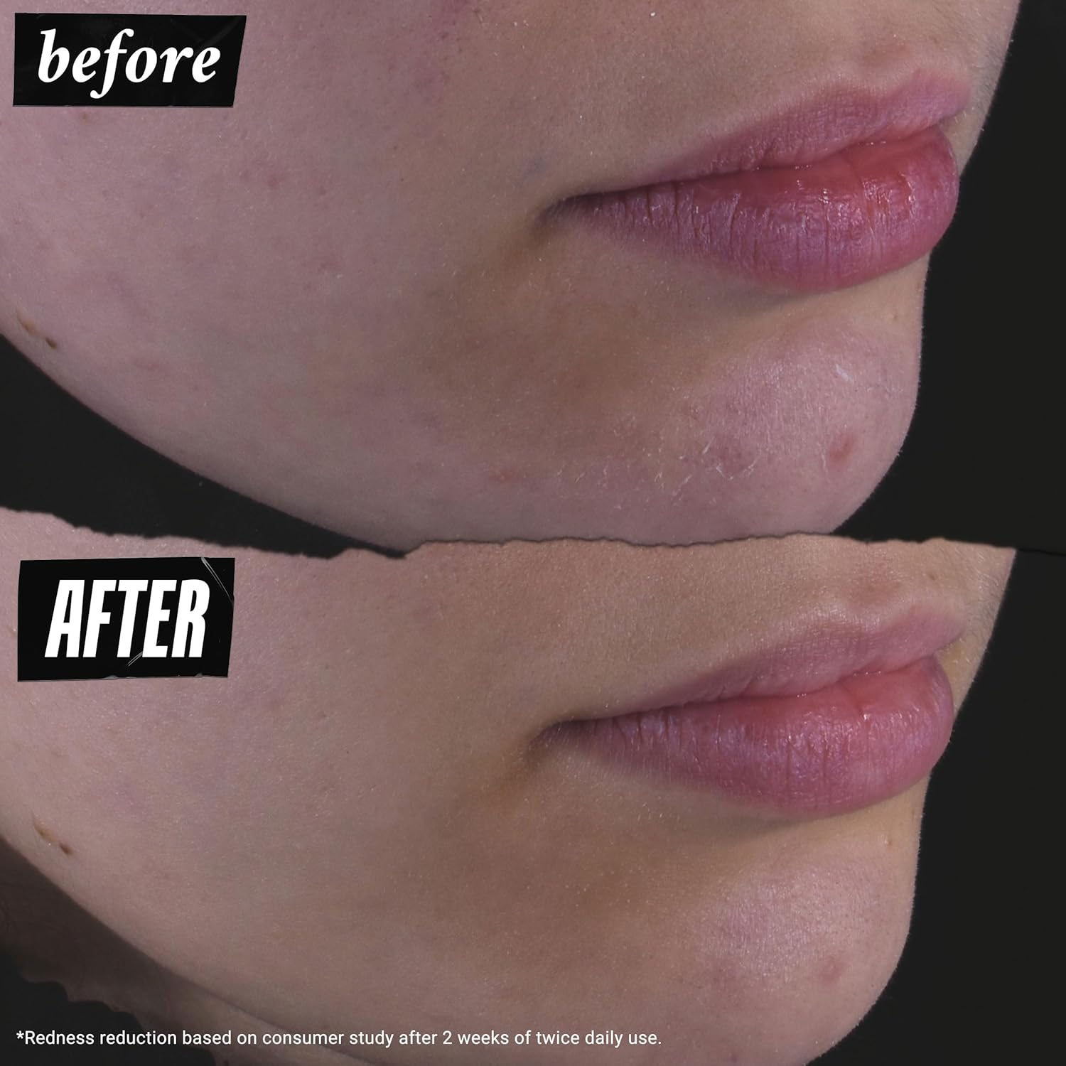 Kiehl'S Calendula Herbal Extract Alcohol-Free Toner - for Normal to Oily Skin Types 500Ml image number 4