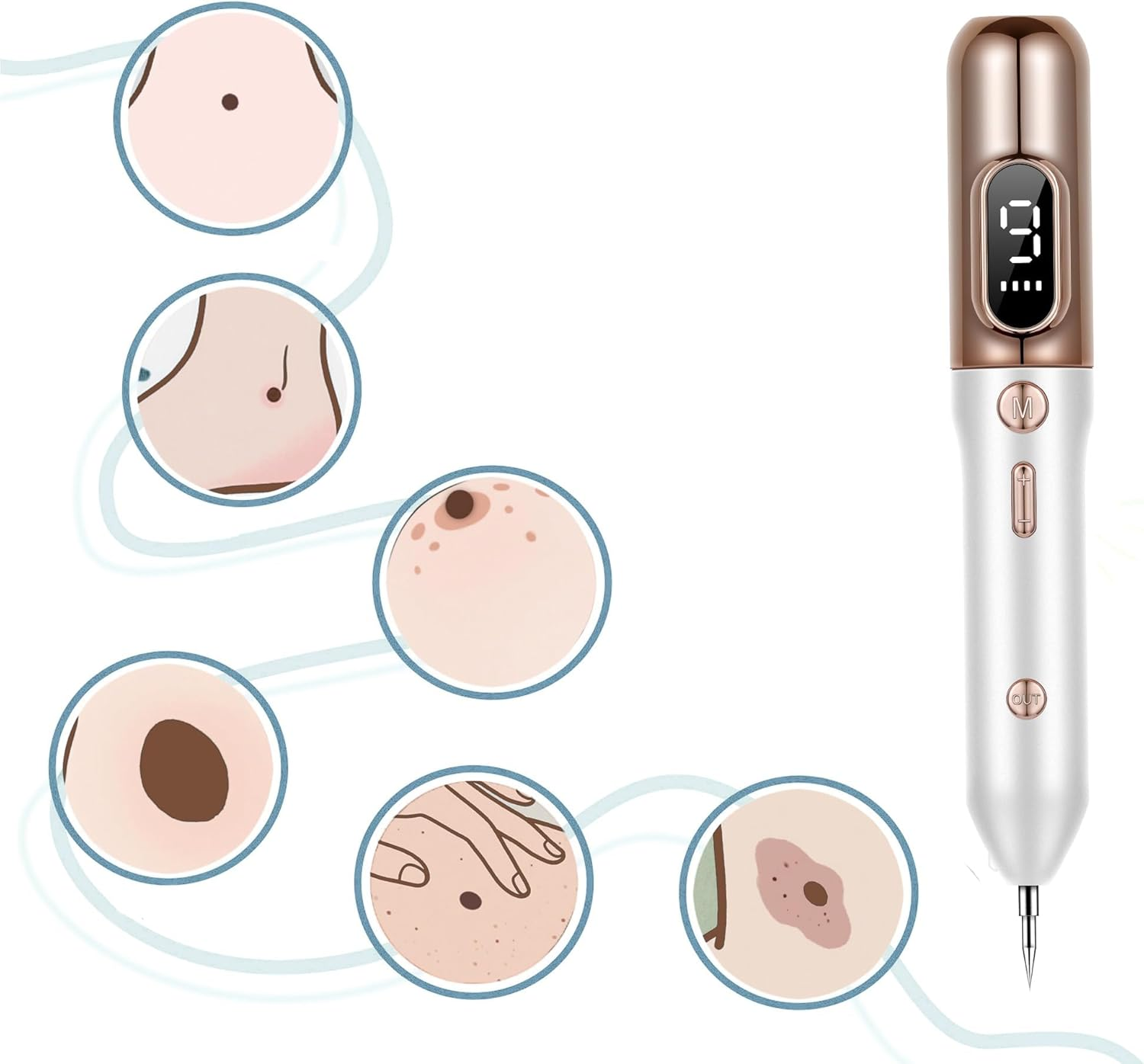 Skin Tag Removal Kit, Skintag Remover Home Use, Portable Removal Kit for Mole, Wart and Skin Tag for Women and Girls, Fast Acting, Safe and Easy to Use, Rose Gold image number 5