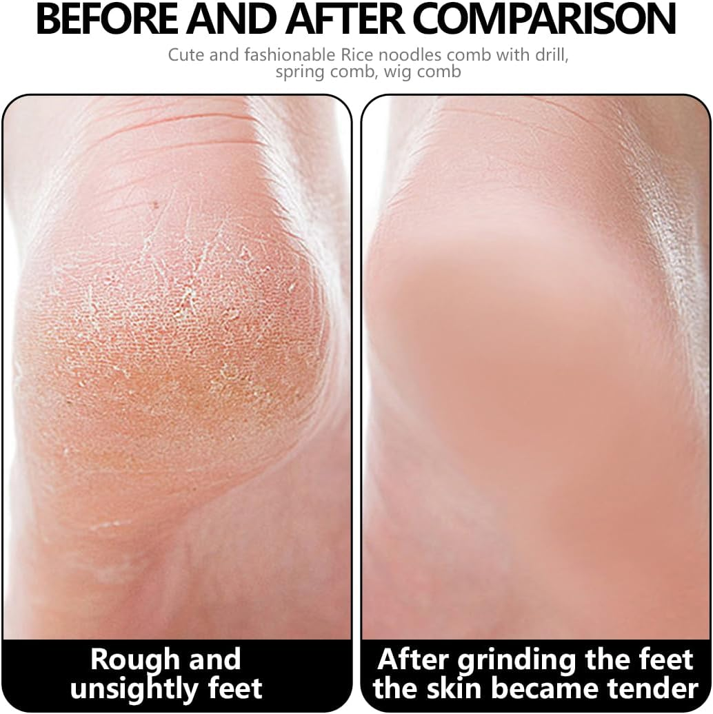 BEPSYOM Double Sided Nano Glass Foot File for Callus Removal - Instantly Reduces Calluses and Corns to Powder