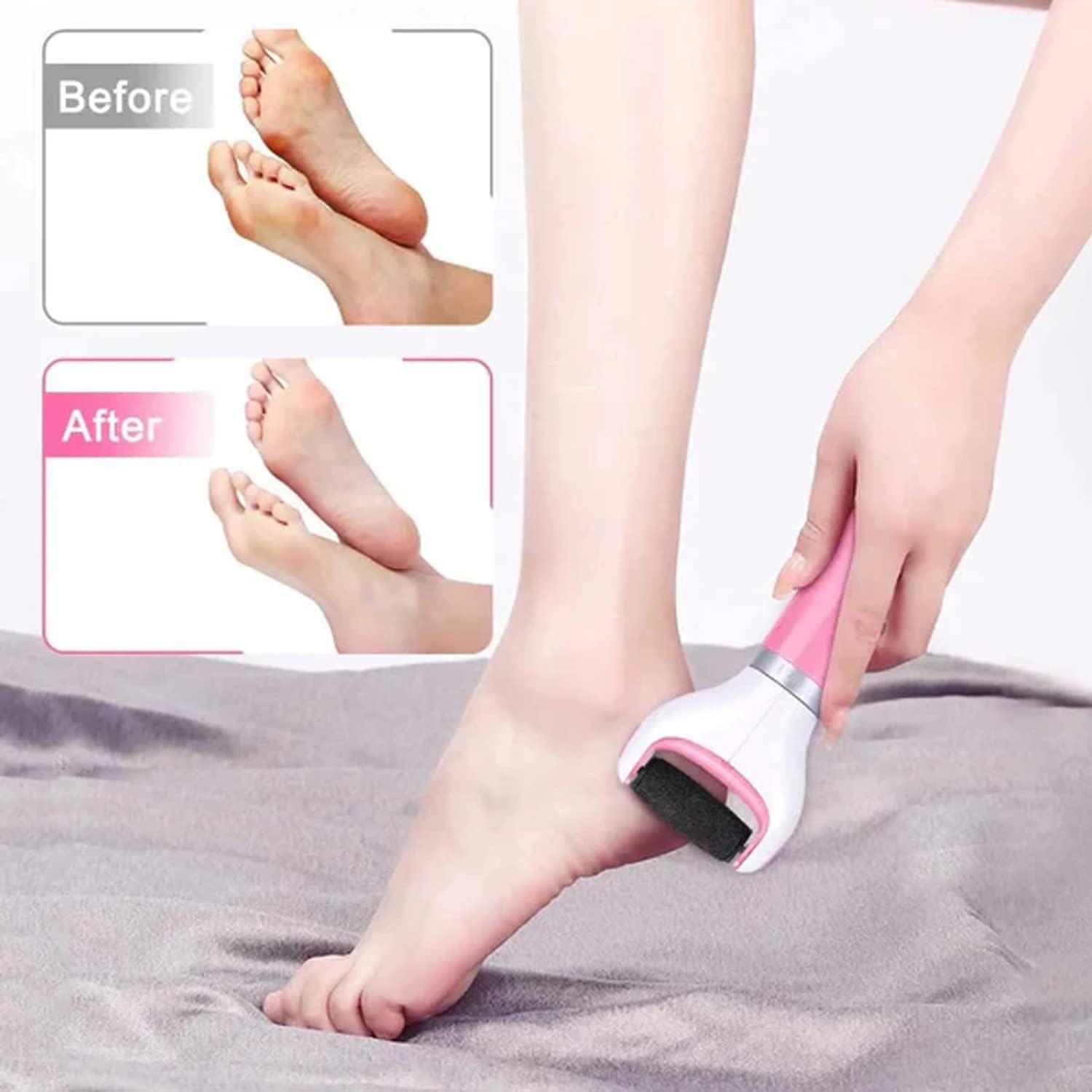 EZONEDEAL Electric Foot Grinder with Roller Head Battery Powered Portable Feet File Pedi Tool Foot Callus Remover for Dead Hard Cracked Dry Skins- Light Pink image number 3