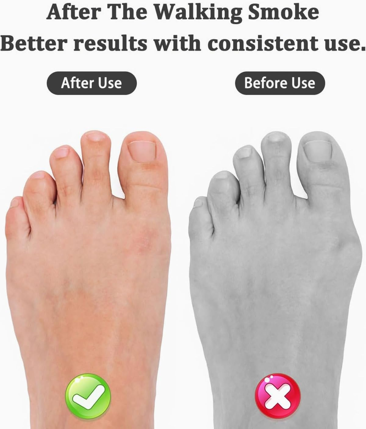 KGDUYC 4 Pairs of Hammer Toe Cushions, Silicone Toe Separators, Hammer Toe Pad Correctors, Wavy Corrector, for Reduces Pain and Friction, for Women and Men - White/Skin Colour image number 3