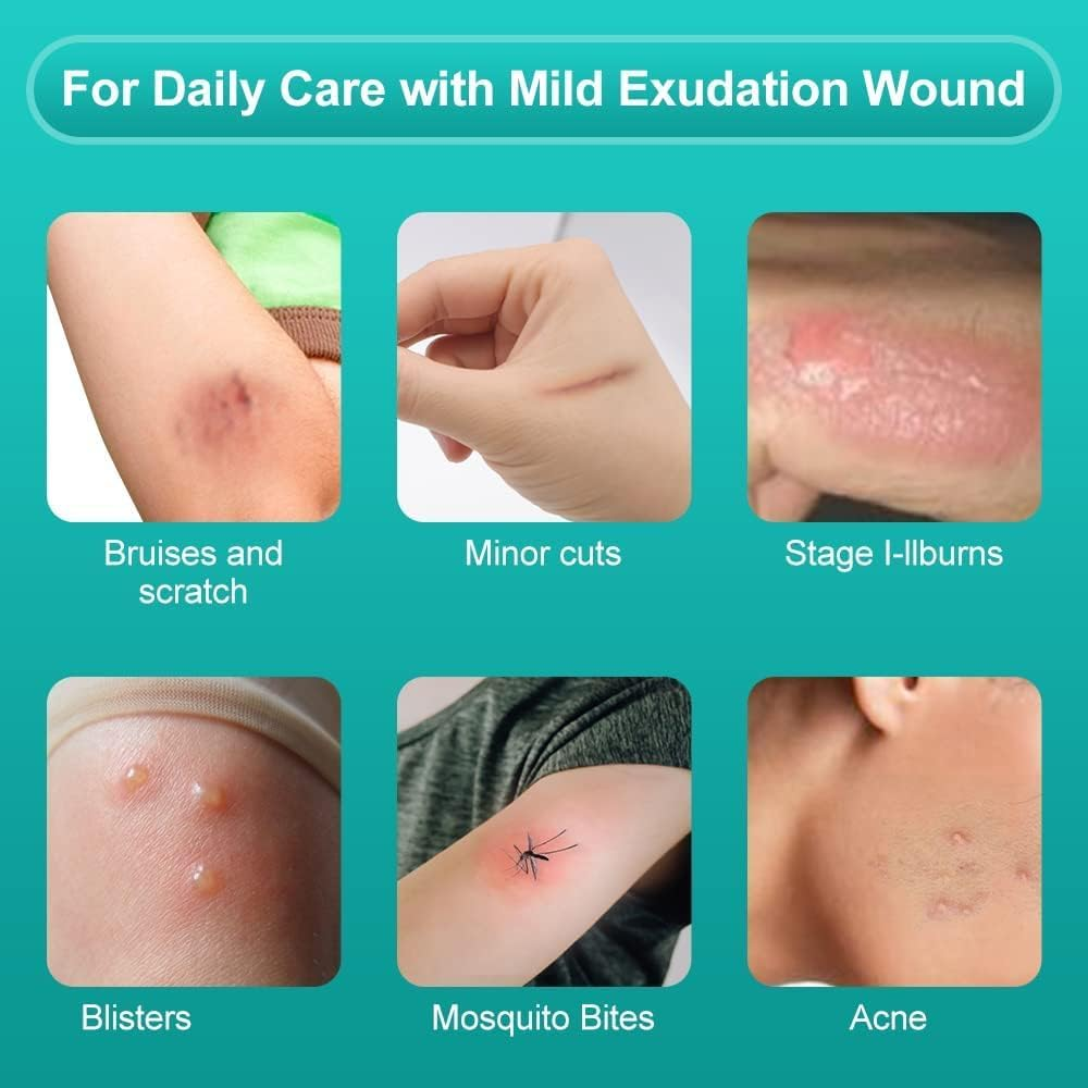 Dimora Hydrocolloid Dressing 10 Pack (7.5Cm X 7.5Cm) | Extra Strong Adhesive Waterproof Blister Plasters for Feet, Heel & Joints | Wound Care for Burns, Bedsores, Acne, Cuts | Fast Healing Gel Bandages image number 6