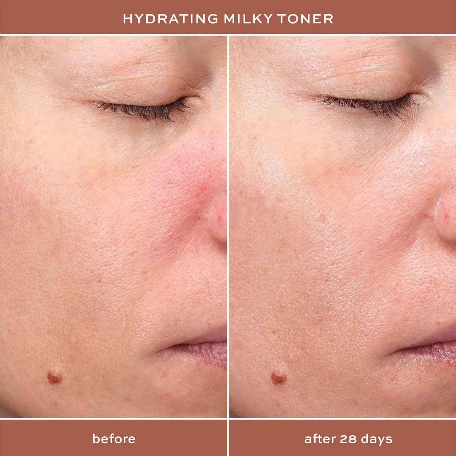 ITK Hydrating Milky Face Toner - Tone + Prep Skin with Hyaluronic Acid + Squalane - Calm + Nourish Skin - Reduces Redness Appearance - Hydrate + Soothe Skin, 5 Fl. Oz image number 3