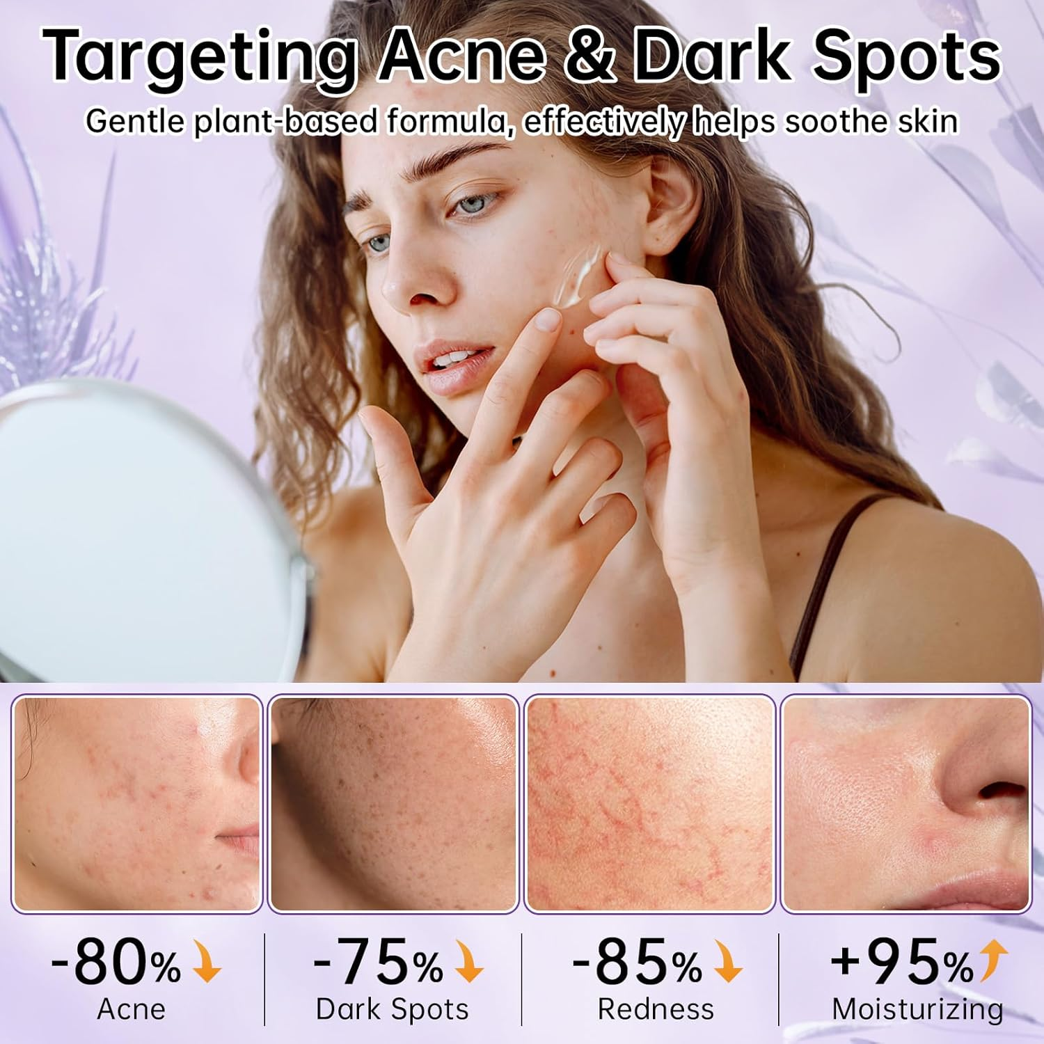 12% Azelaic Acid Cream with Niacinamide & Hyaluronic Acid, Face Moisturizer for Dark Spots, Acne, Redness & Pore Care, Azelaic Acid Serum for Sensitive Skin, Balances Oil, 20 G