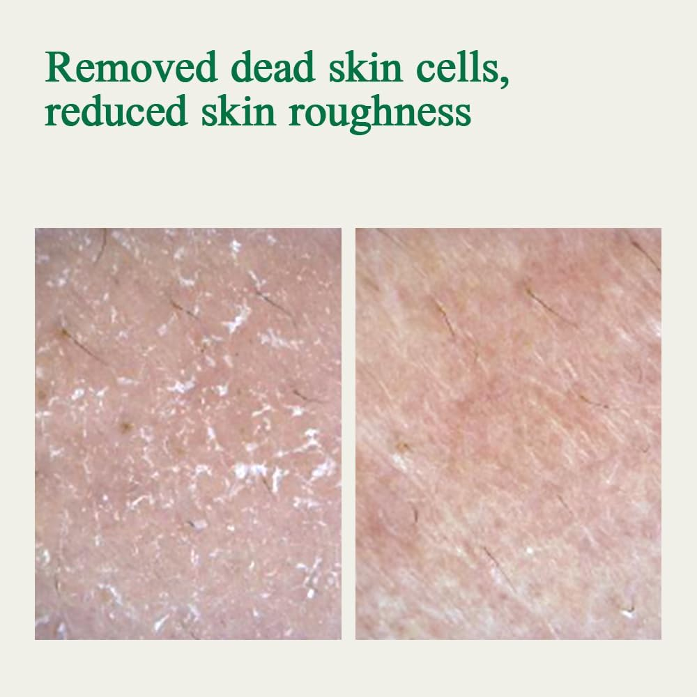 Pyunkang Yul [PKY] Ultimate Calming Solution Ampoule with Shea Butter, Honeysuckle Flower, Ceramides, CICA to Rapidly Soothe, Moisturize Dry & Sensitive Skin, Korean Facial Beauty Care (1.0 Fl. Oz, 30Ml) image number 5