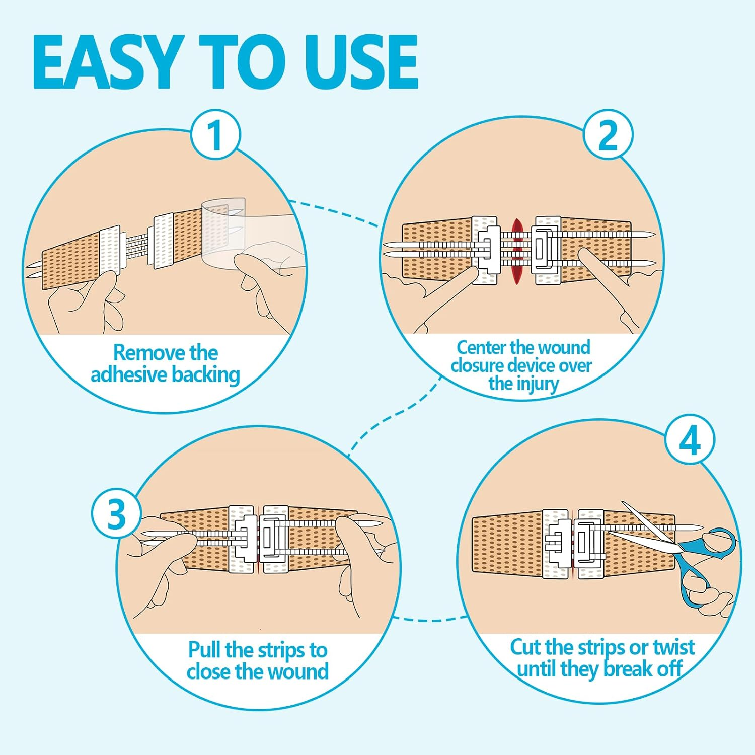 Emergency Wound Closure Device, Zip Stitch Sutures Bandaids Kit 2 Pcs- Repair Wounds without Stitches, Great for Outdoor Activities Such as Hiking, Exploring Wild Nature, Quick Clot