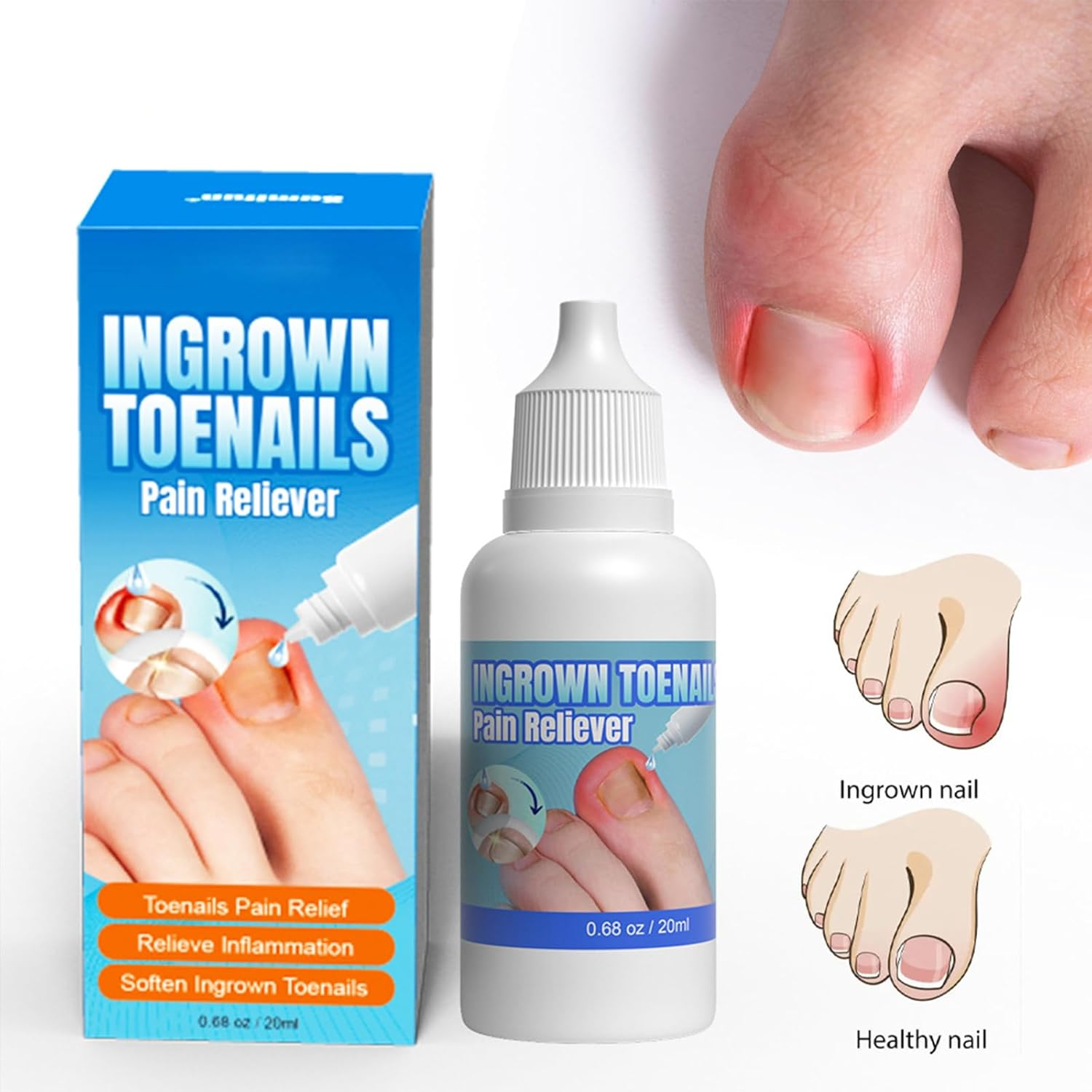Ingrown Toenail Treatment - Ingrowing Toenail Treatments - Ingrown Nail Treatment for Toenails Extra-Strong image number 4