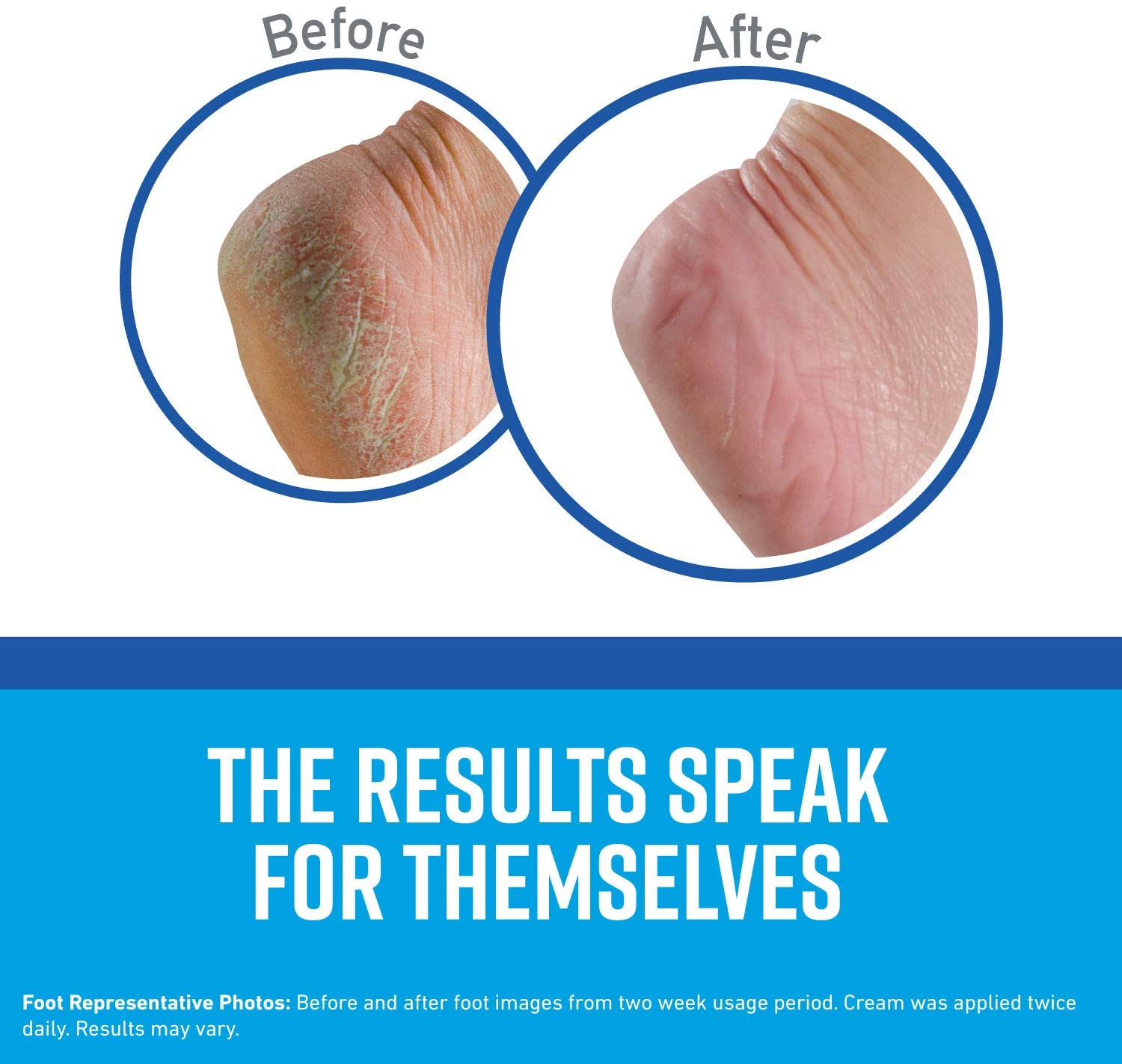 O'Keeffe'S K0320001-5 Healthy Feet Foot Cream in Jar (5 Pack), 3.2 Oz image number 2