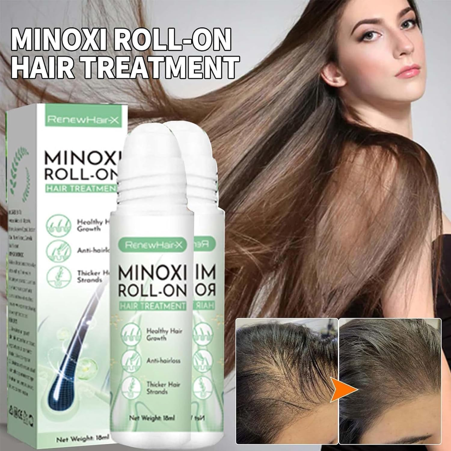 3 Pcs Renew Hair X Roll-On Hair Treatment,Renewhairx Hair and Beard Regrowth Roll on Serum,Beard Hair Regrowth Treatment Works on All Hair image number 6