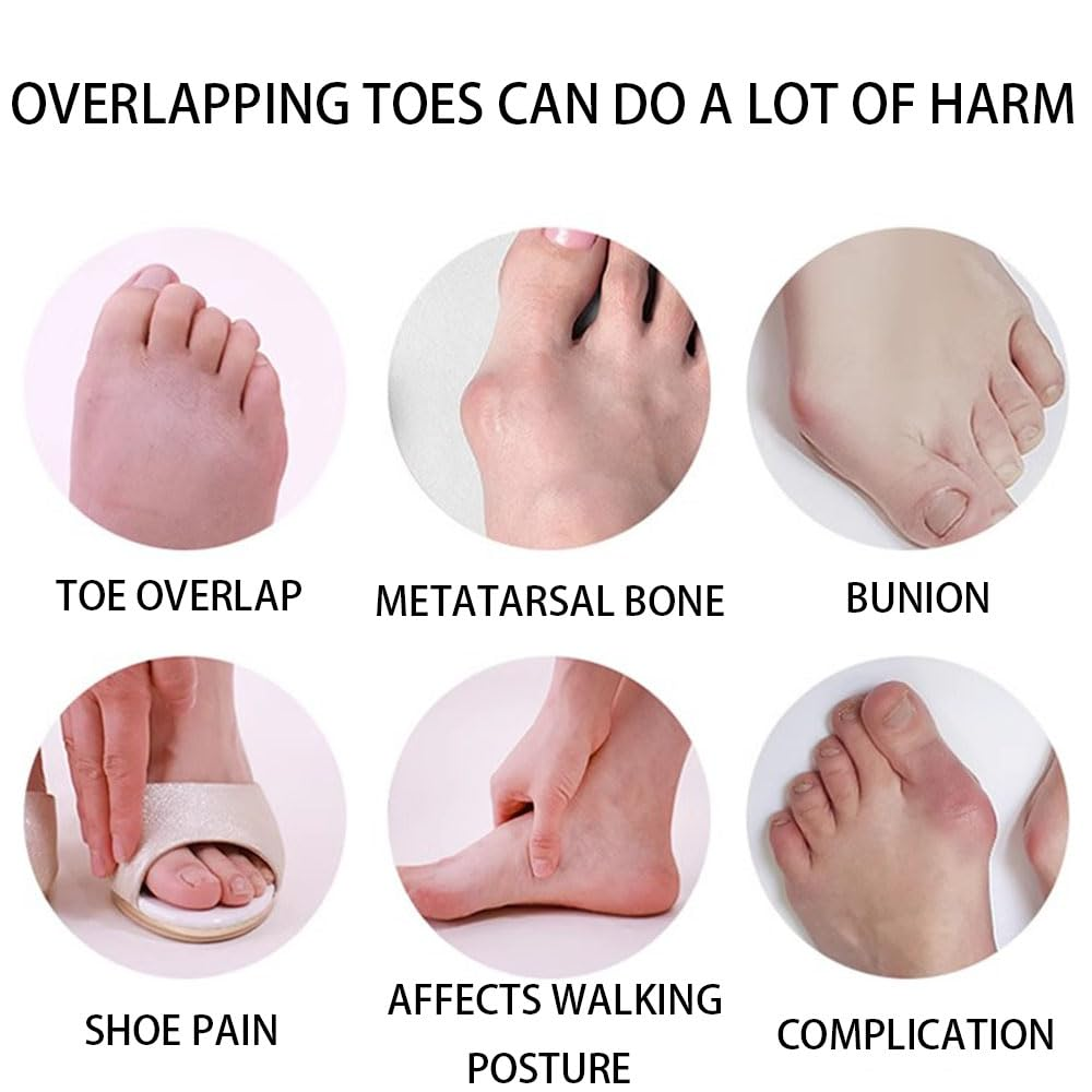 Toe Separator,6 PCS Toe Spacers for Men & Women,Correcting Bunions and Restoring Toes to Their Original Shape(Blue/Pink/White) image number 1