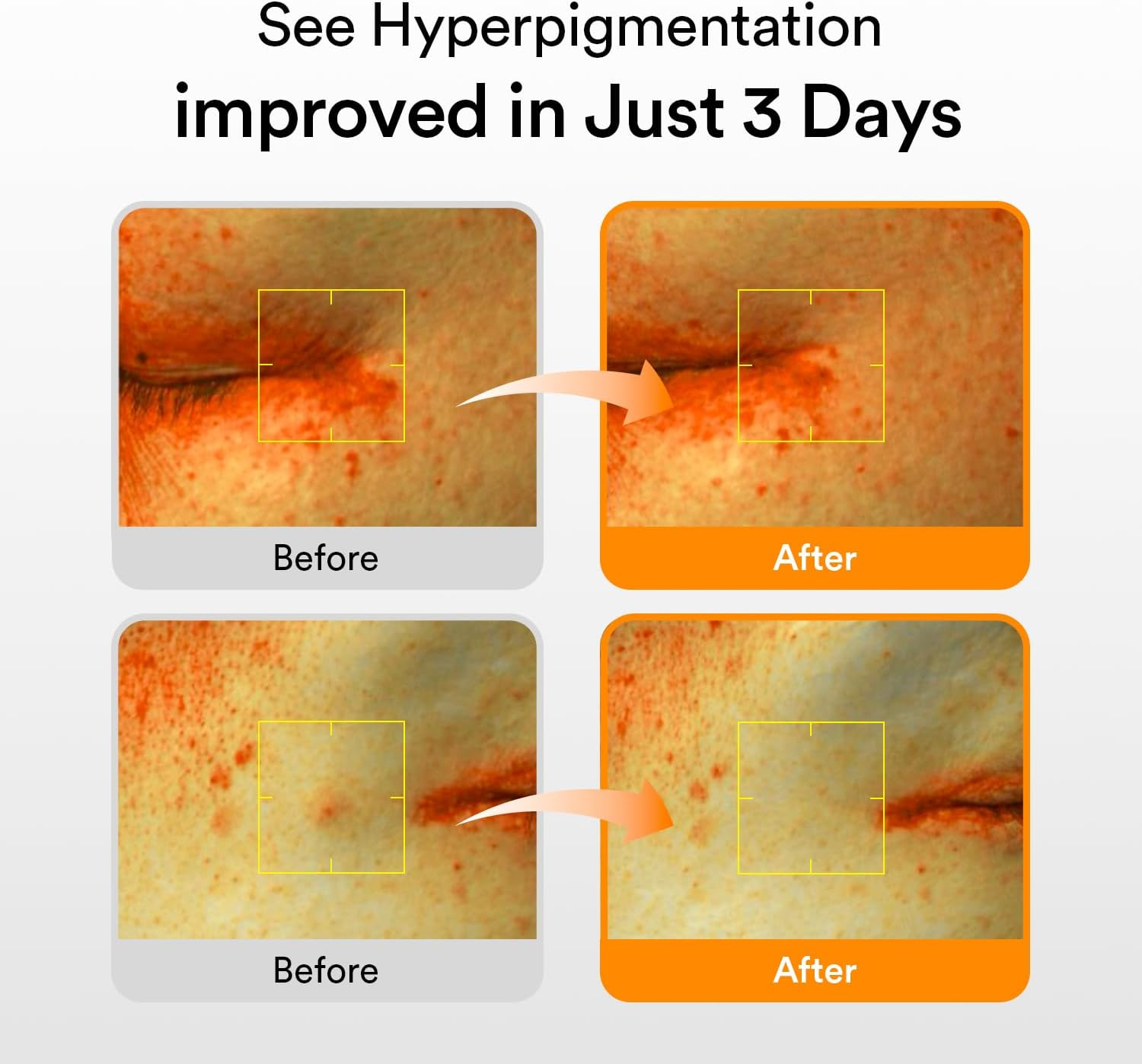 Abib Glutathiosome Dark Spot Serum Vita Drop 50Ml / 1.69 Fl.Oz. | Korean Skincare, Dark Spot, Hyperpigmentation Treatment | Brightening Serum for Sensitive, Uneven Skin | Niacinamide, Vitamin C image number 1