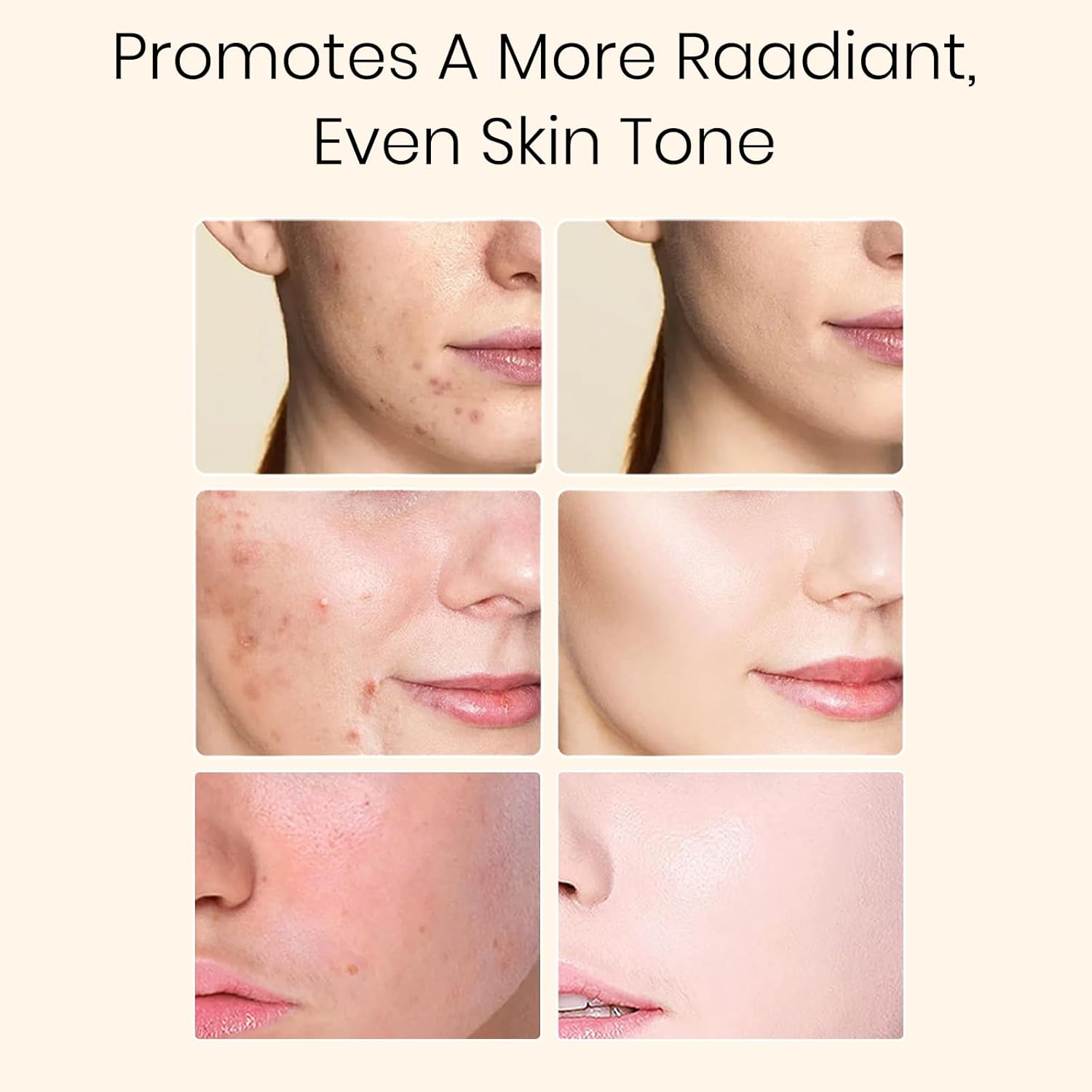 Glycolic Acid 7% Exfoliating Toner for Hydrating & Smoothening, Multi-Functional Gentle Serum for Face, Body & Underarms, Help with Skin for Women & Men - 240Ml (8.44 Fl Oz)