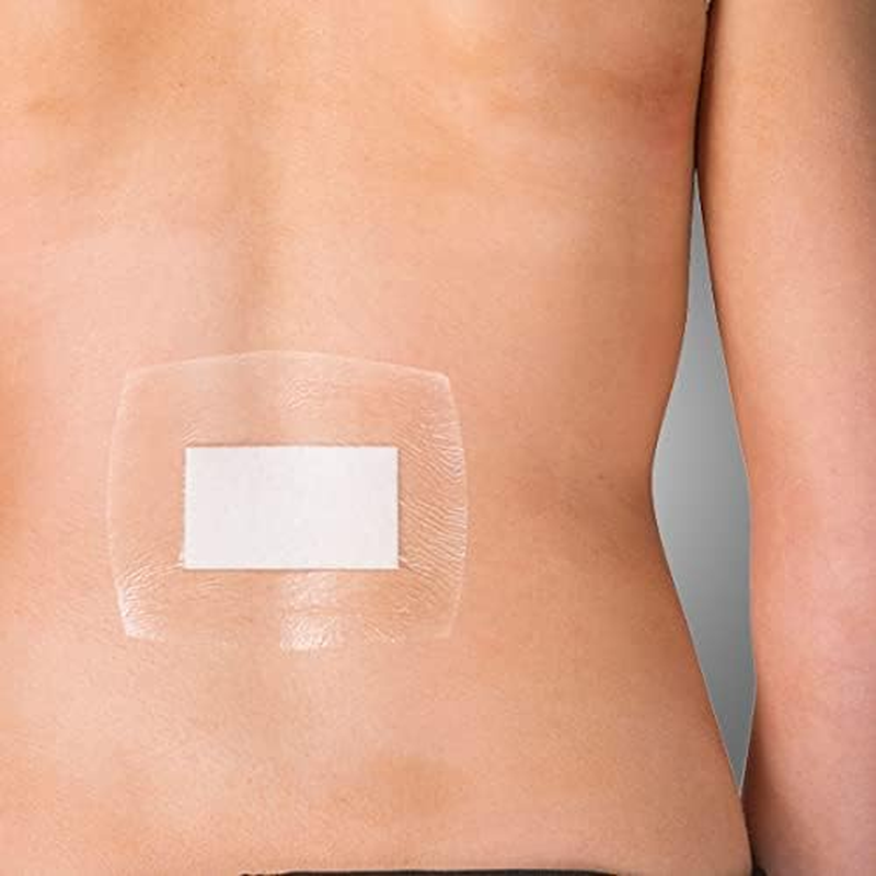 AEROFILM plus Waterproof Island Dressing, Waterproof Dressing Barrier with Transparent Film and Absorbent Pad for Post‑Operative Care, Hypoallergenic Adhesive, Frame Delivery, 10 X 12 Cm, Box of 20 image number 1