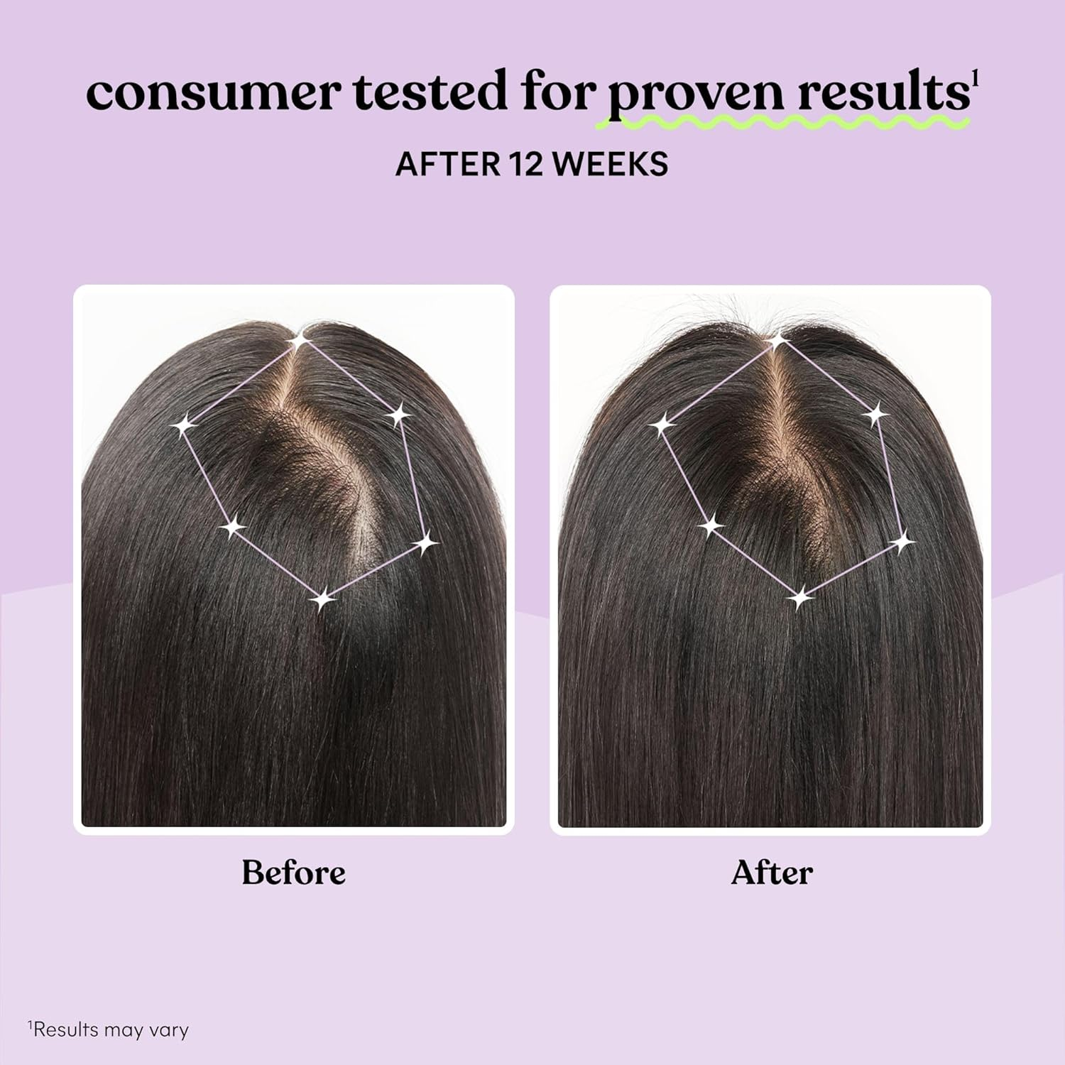 Lemme Grow Hair Growth Supplement for Women, Clinically Proven Keratin Complex for Visibly Thicker Hair and Scalp Coverage, Reduced Shedding, Nourish Thinning Hair - 1 Month Supply image number 2