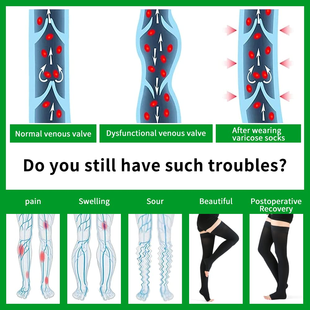 VARCOH Compression Socks for Women Thigh High Open Toe, plus Size Compression Stockings 20-30 Mmhg Good for DVT, Pregnancy, Varicose Veins,Edema image number 5