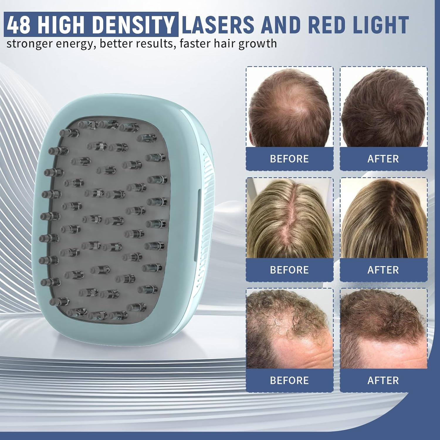 Laser Comb for Hair Growth, Red Light Therapy for Hair Growth, Laser Hair Growth Device Medical Grade Lasers, Stimulates Hair Growth, Reverses Thinning image number 3
