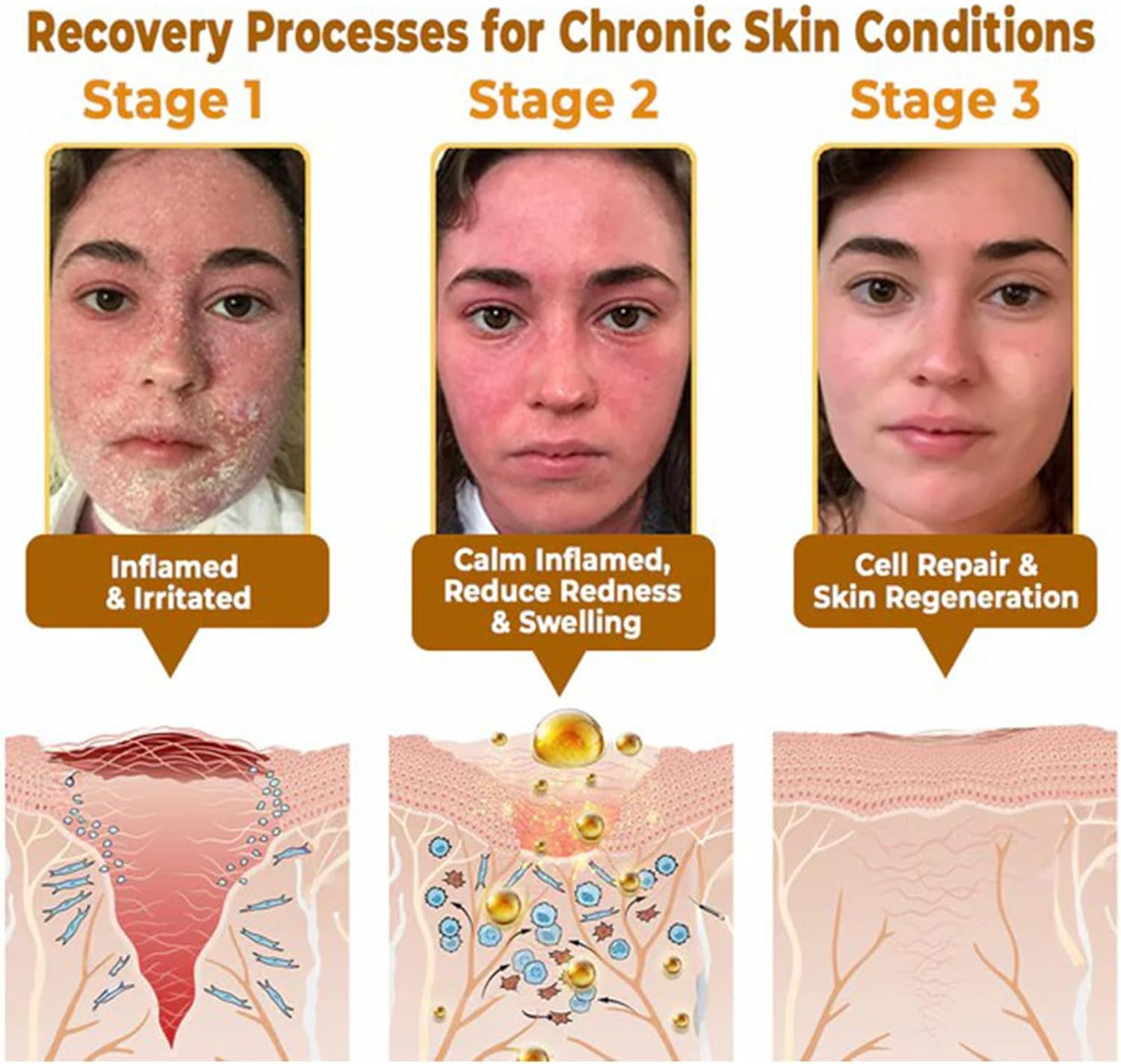 PLTOWE Bee Venom All-In-One Cream,Bee Venom Cream,Tlopa Bee Venom Skin Treatment Cream,Improve Skin Quality and Resolve Skin Problems (3) image number 3