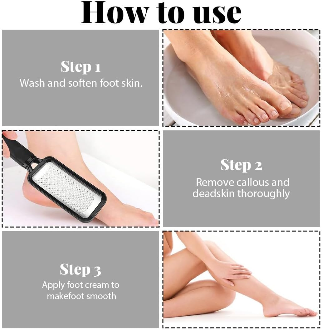 JYNXOR 1 X Callus Remover Stainless Steel Double-Sided (Coarse, Fine) for Foot Care, Callus Rasp, Manual Pedicure Callus File for Callus Removal, Soft, Quick, Easy to Clean image number 1